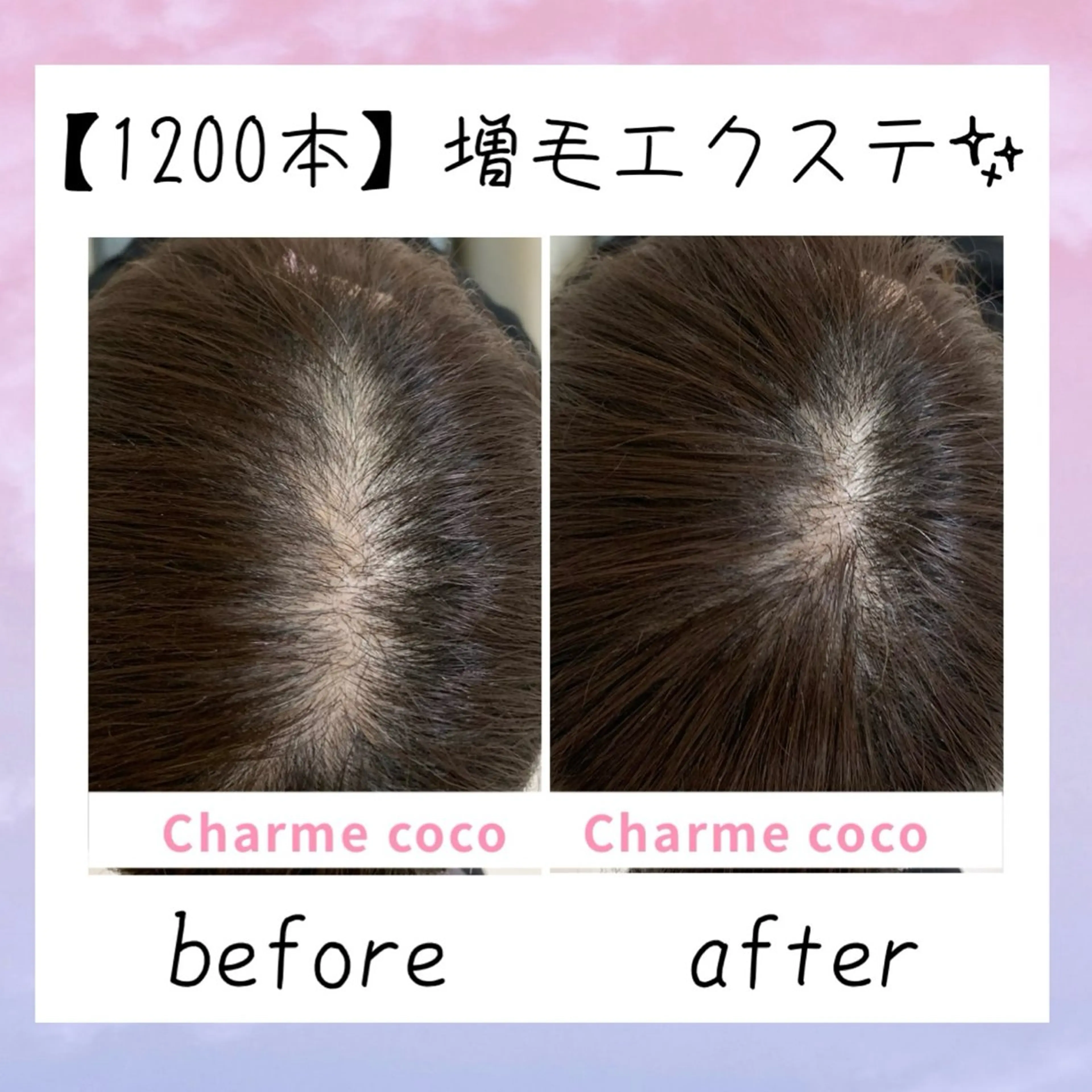 ショート エクステ 髪質改善 エクステ 肌質改善Charme coco  増毛のエステ・リラクイメージ