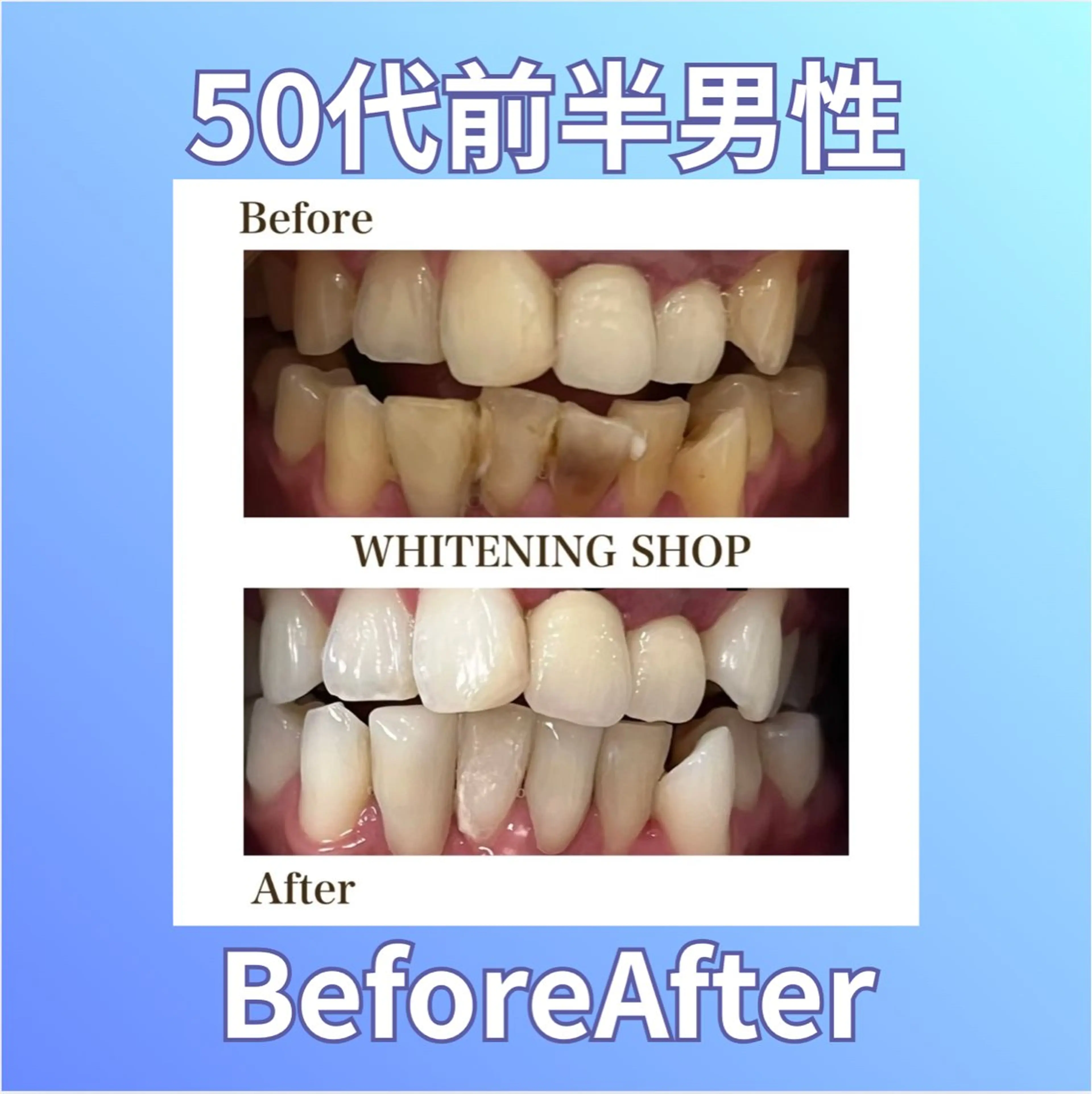 ホワイトニングショップ西原所属・下川 藍子のその他イメージ