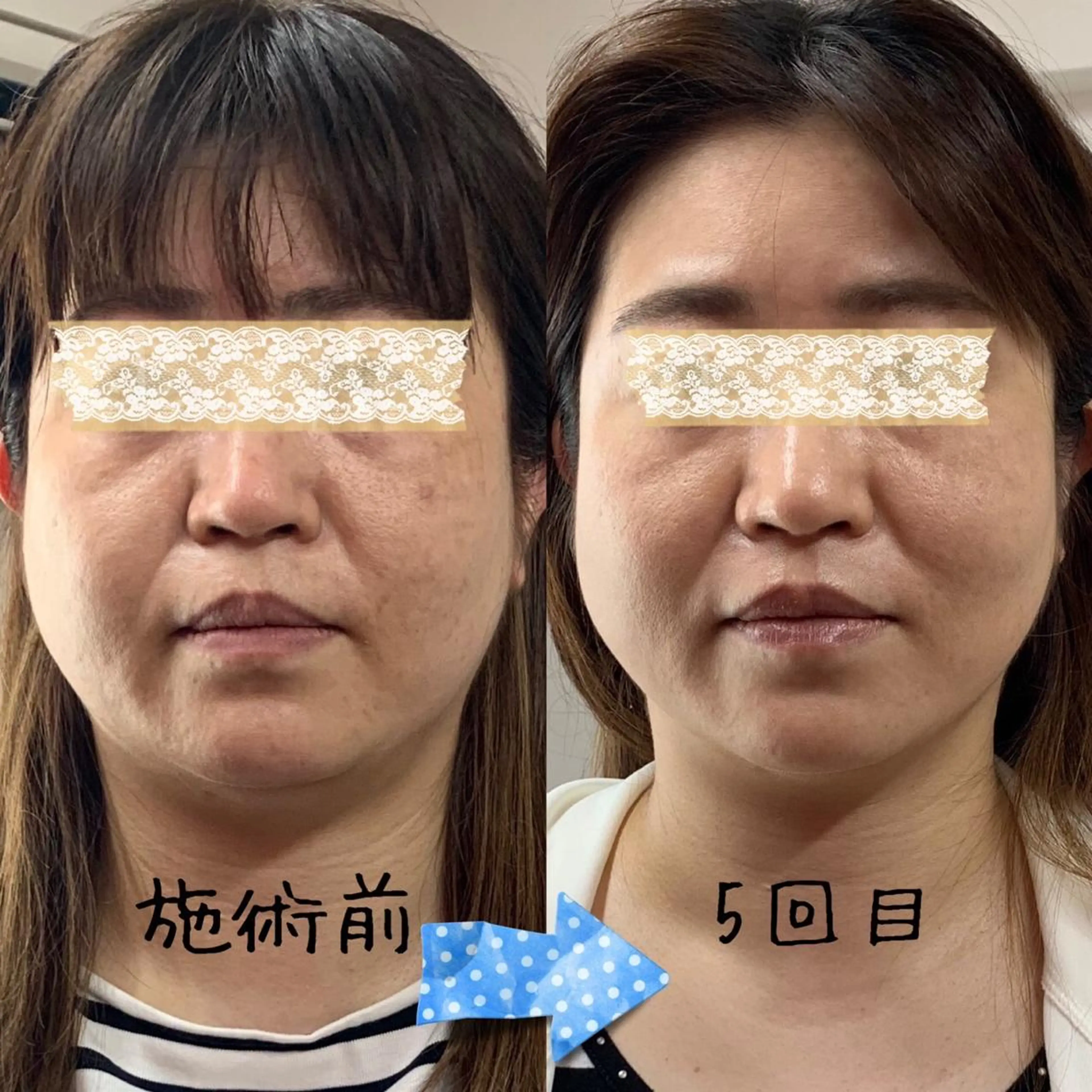 リラクゼーション サロンせいらんのエステ・リラクイメージ