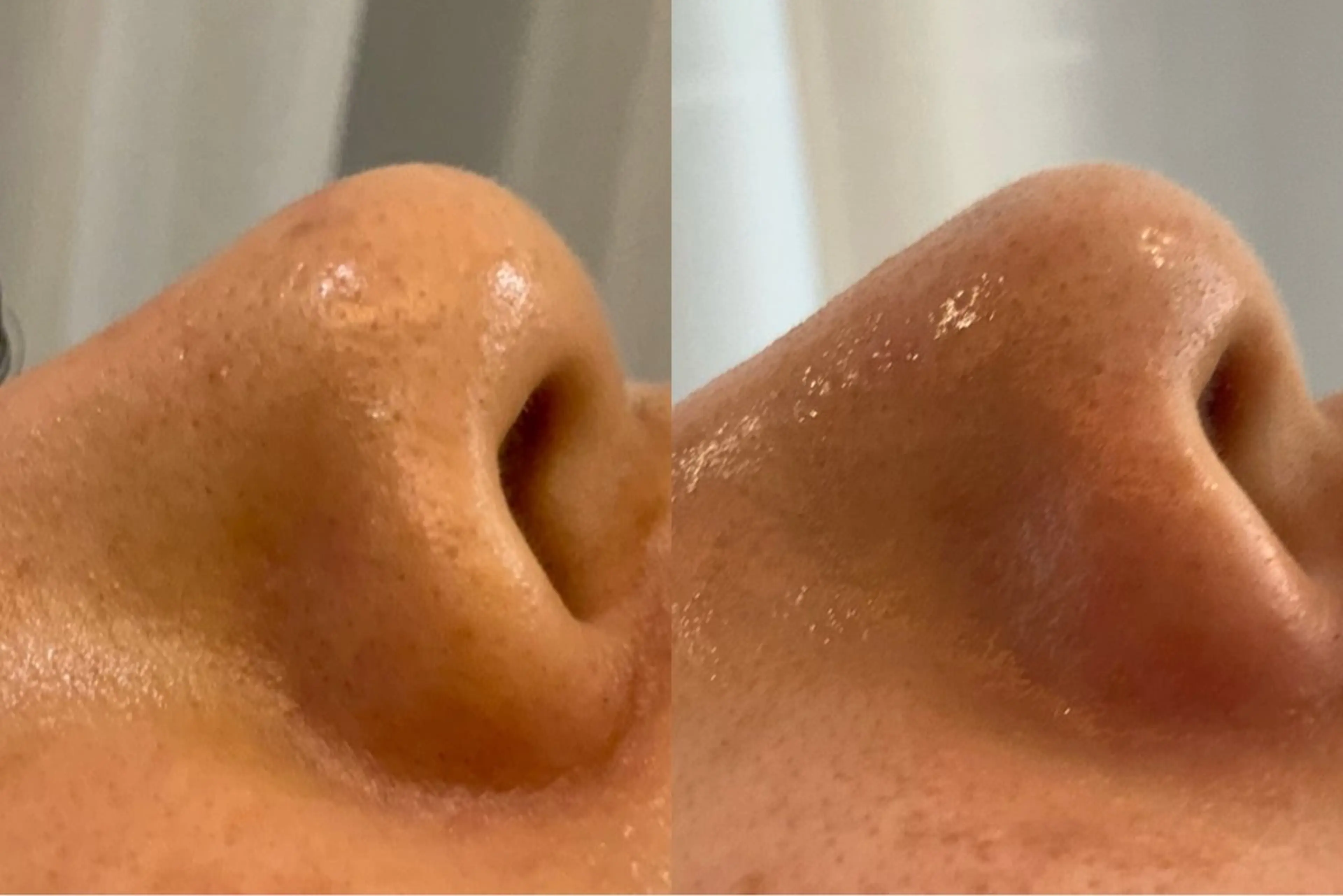 最速小顔・肌質管理 espoirマキのエステ・リラクイメージ