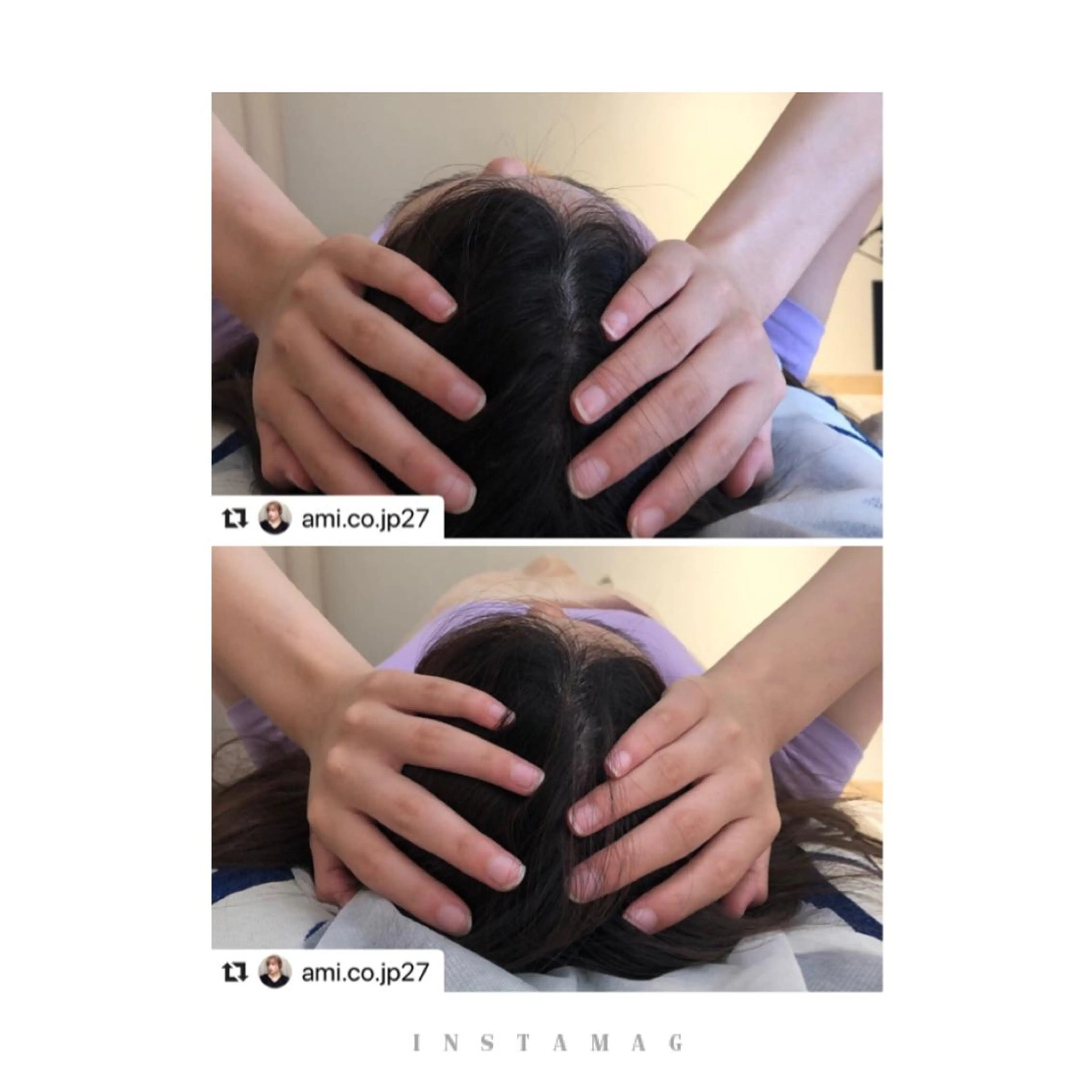 鍼灸整骨院Refine所属・鍼灸 Refineのその他イメージ