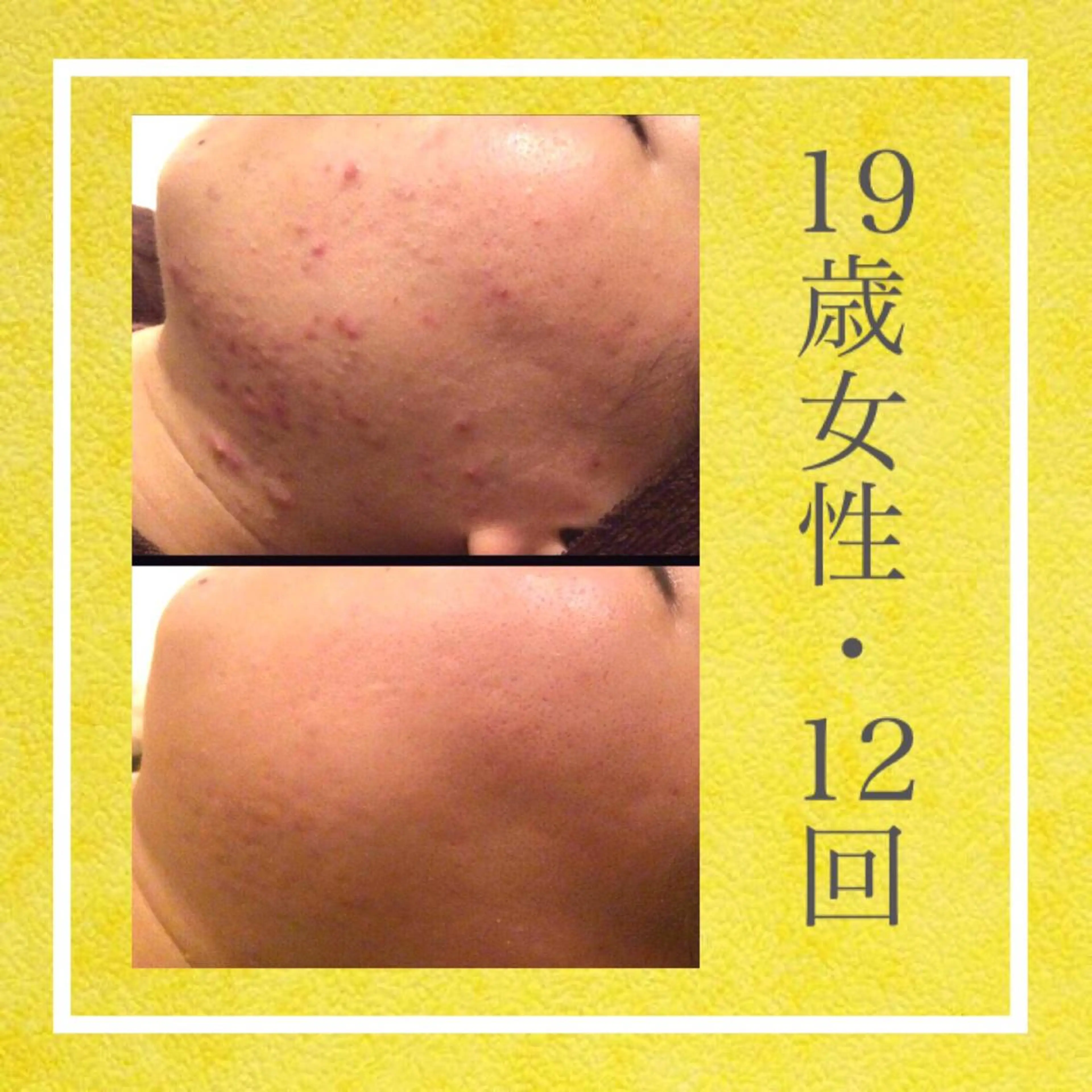 ミディアム カラー パーマ ヘアアレンジ メンズ キッズ ネイル マツエク・マツパ エステ リラク ニキビ・肌質改善専門 ♡人生が変わるサロンのエステ・リラクイメージ