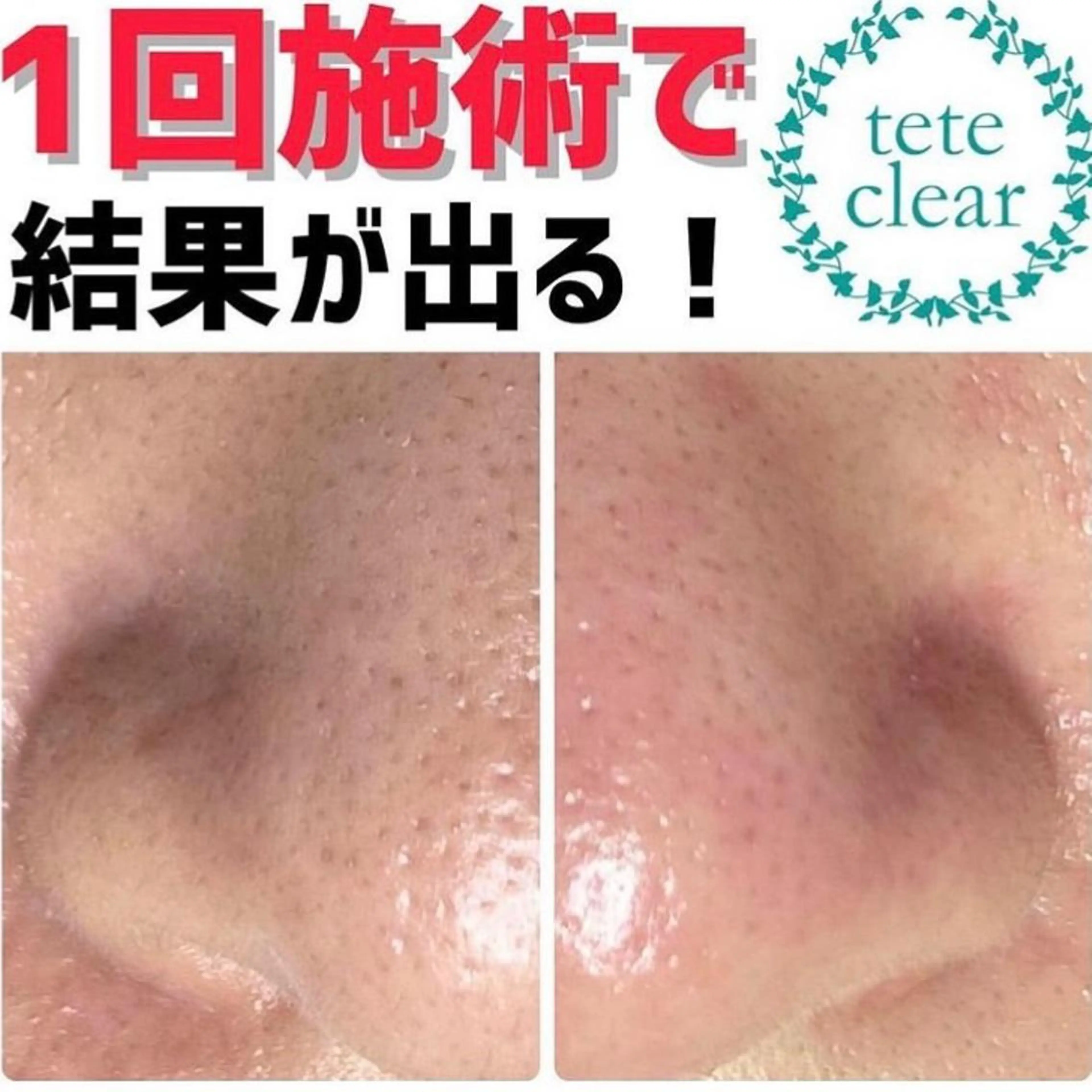 毛穴肌質ケアサロン Yourmeユアミーのエステ・リラクイメージ