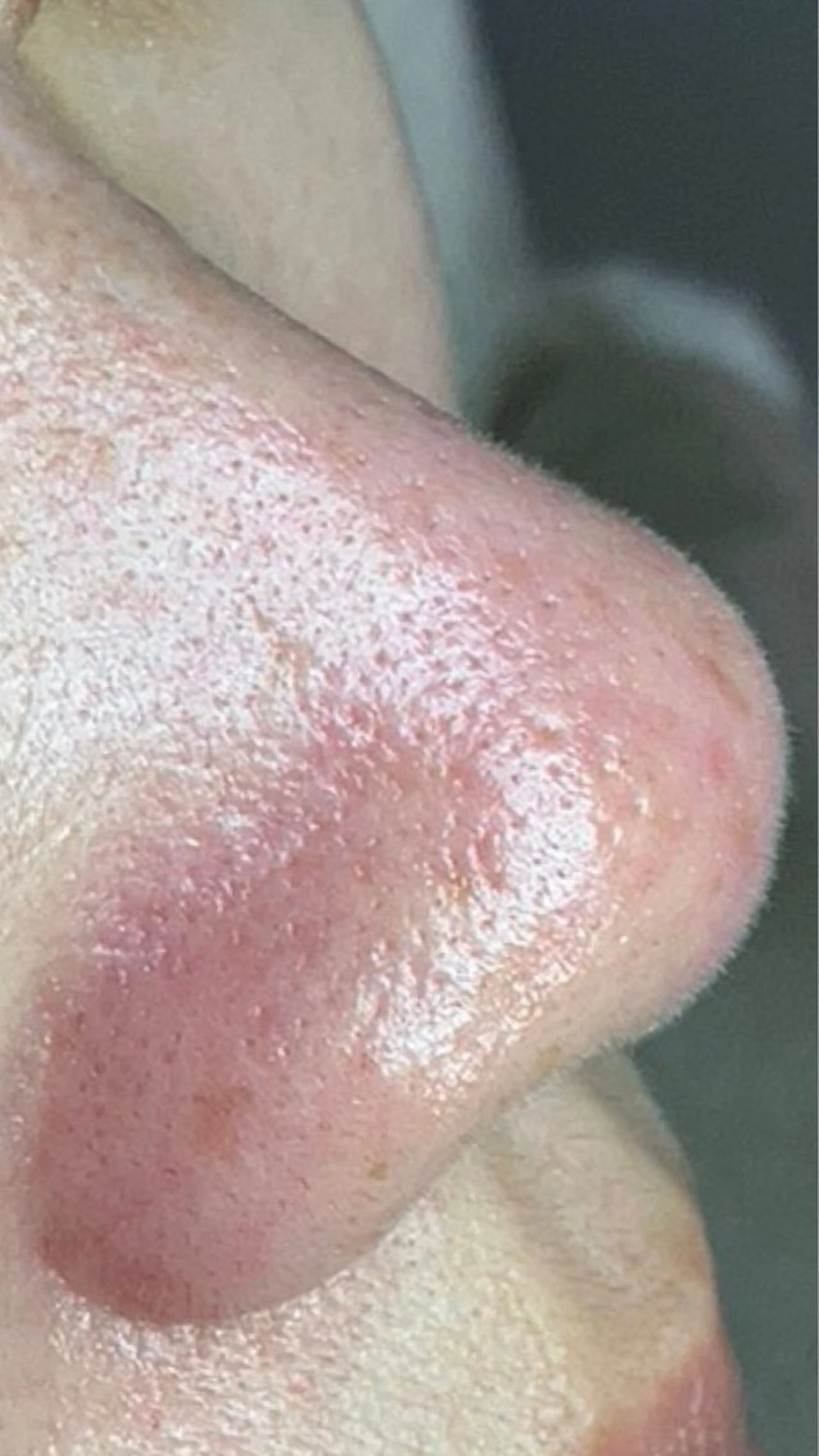 毛穴肌質ケアサロン Yourmeユアミーのエステ・リラクイメージ