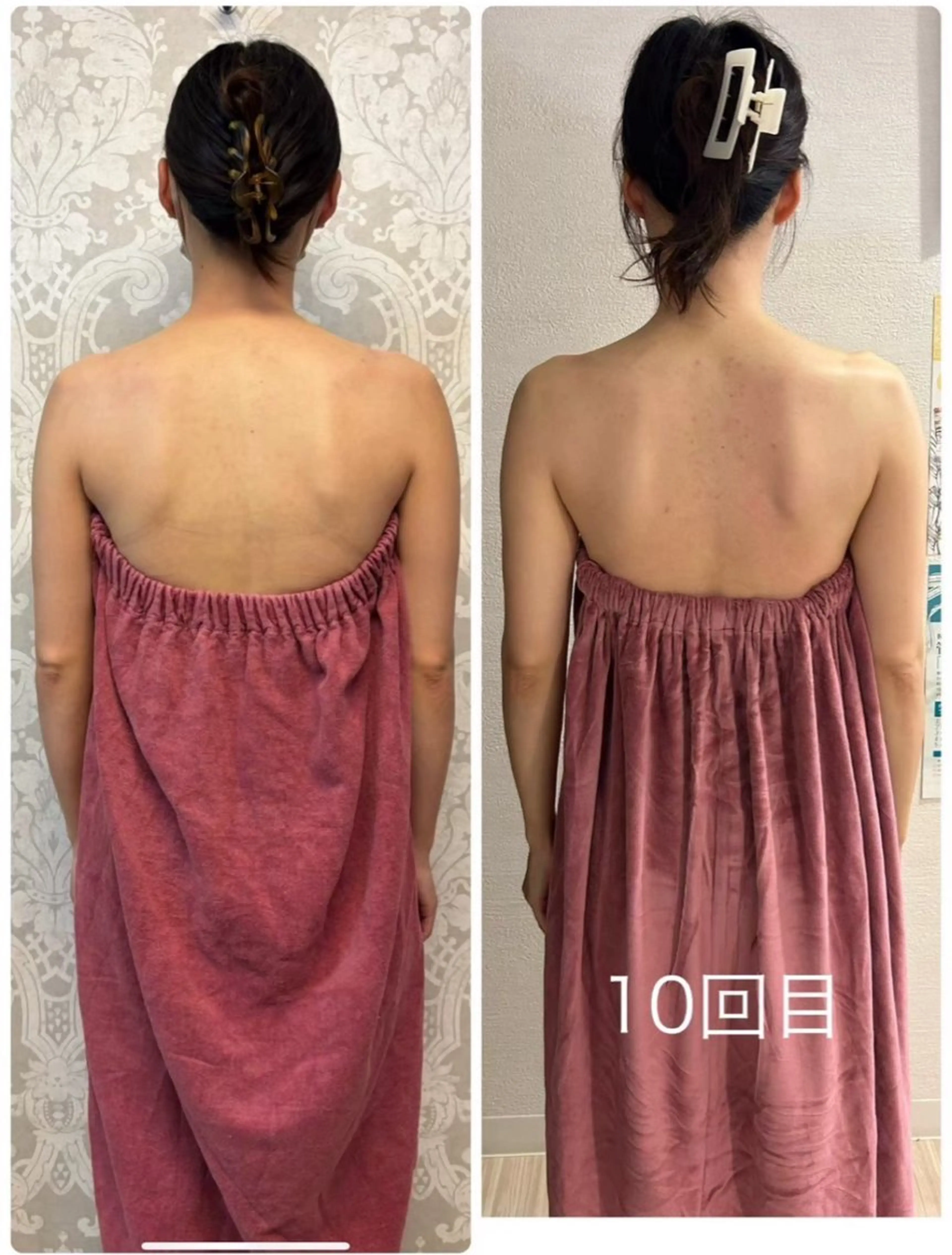 巻き肩猫背根本改善🎀バストコースの写真