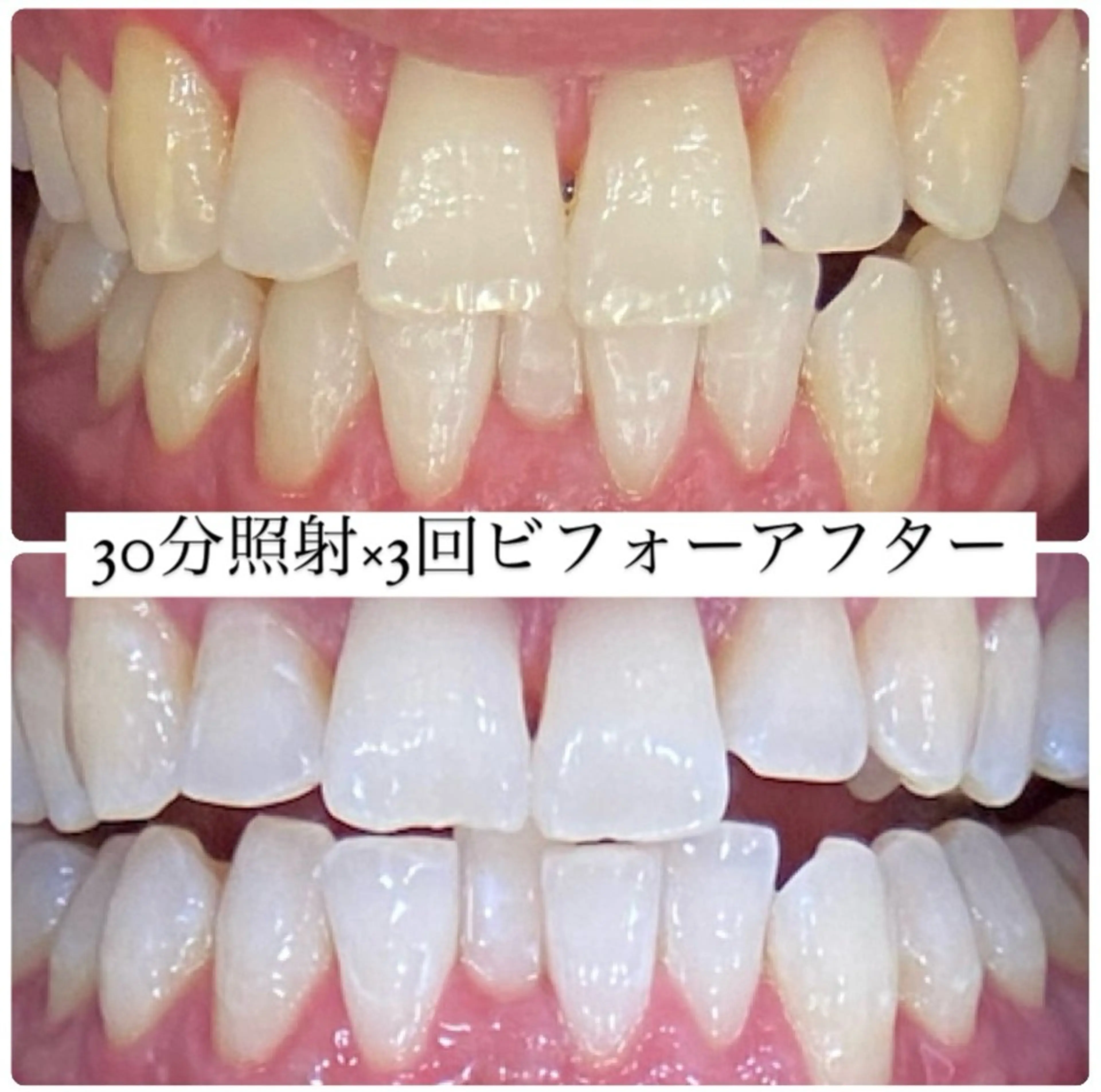 PLATINUM Beauty 横浜店所属・ホワイトニングルーム 横浜店のその他イメージ