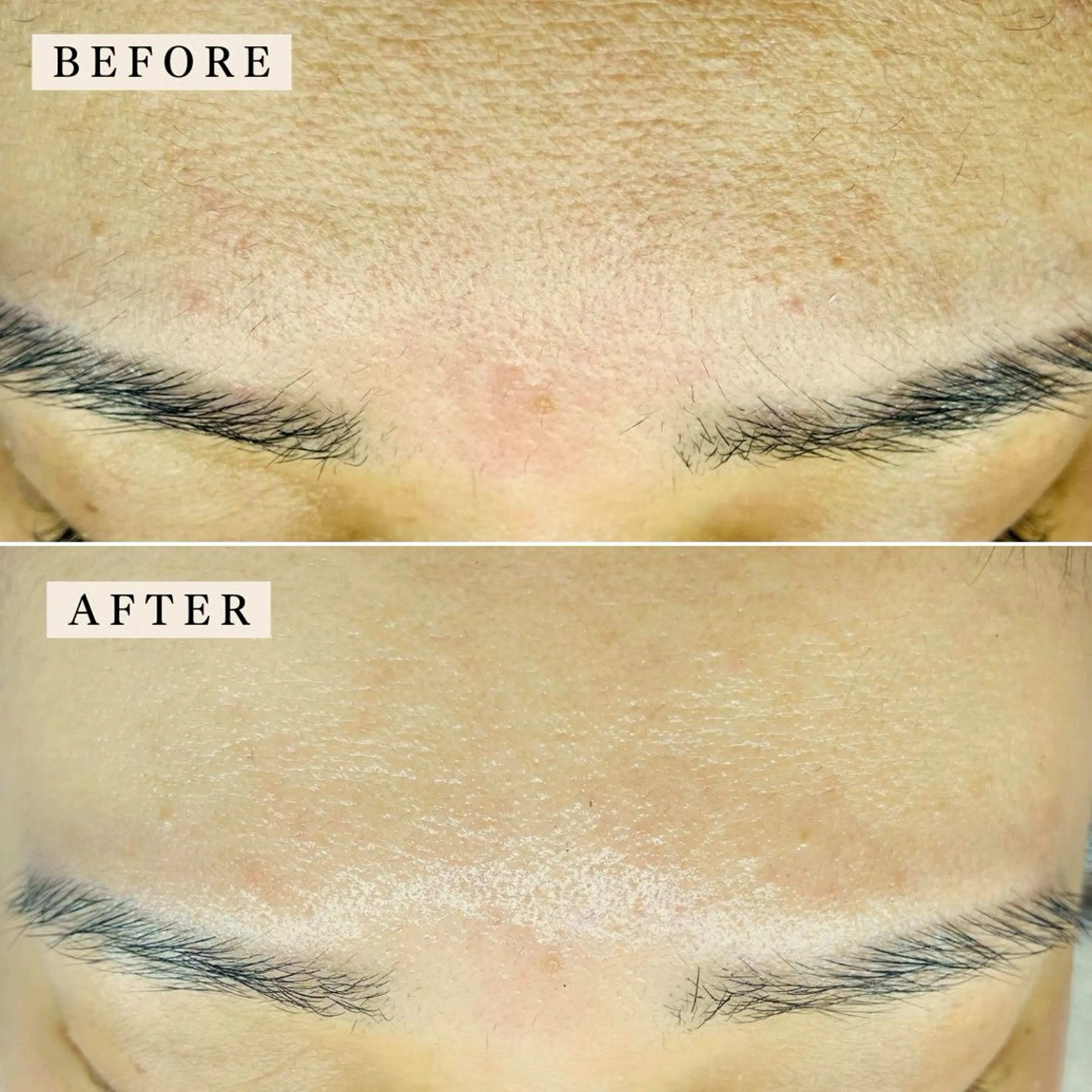 その他 【産毛・眉毛ケア&肌質改善サロン】*BiBi*beautysalon所属・眉・産毛専門BiBi 糸脱毛スレッティングのエステ・リラクイメージ