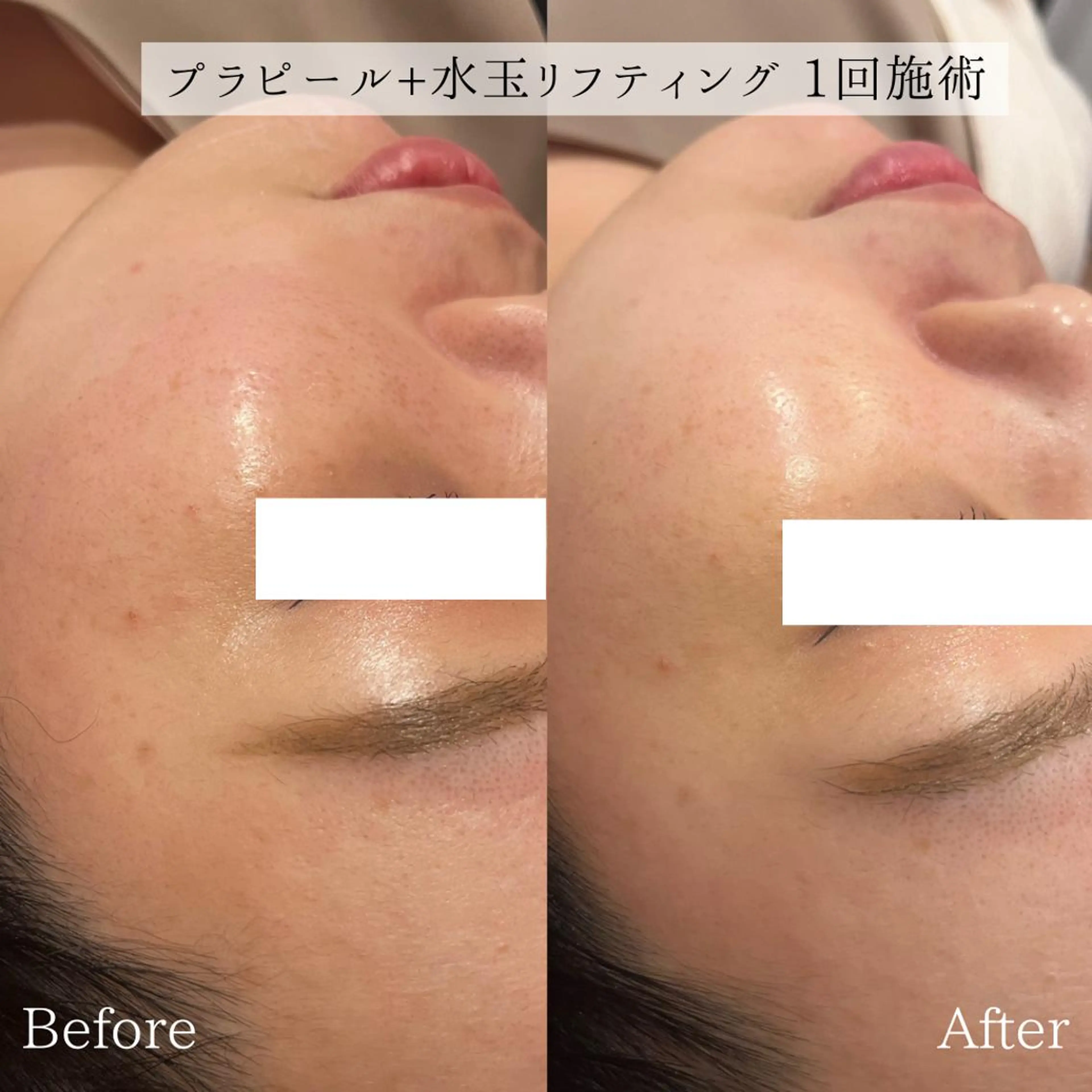 エステ 小顔美肌：ミアンカ 京阪モール本館1Fのエステ・リラクイメージ