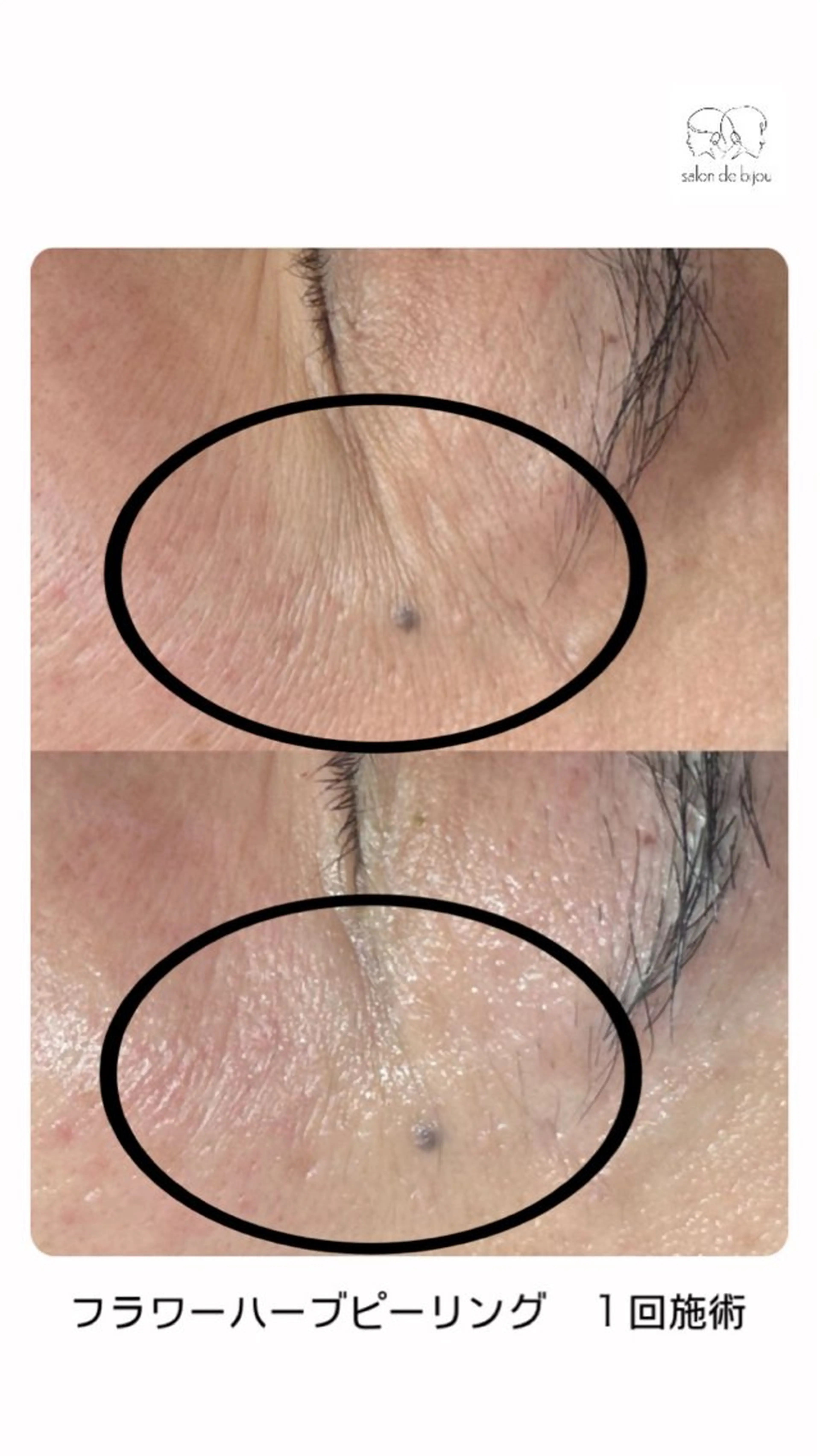 salon debijouのエステ・リラクイメージ