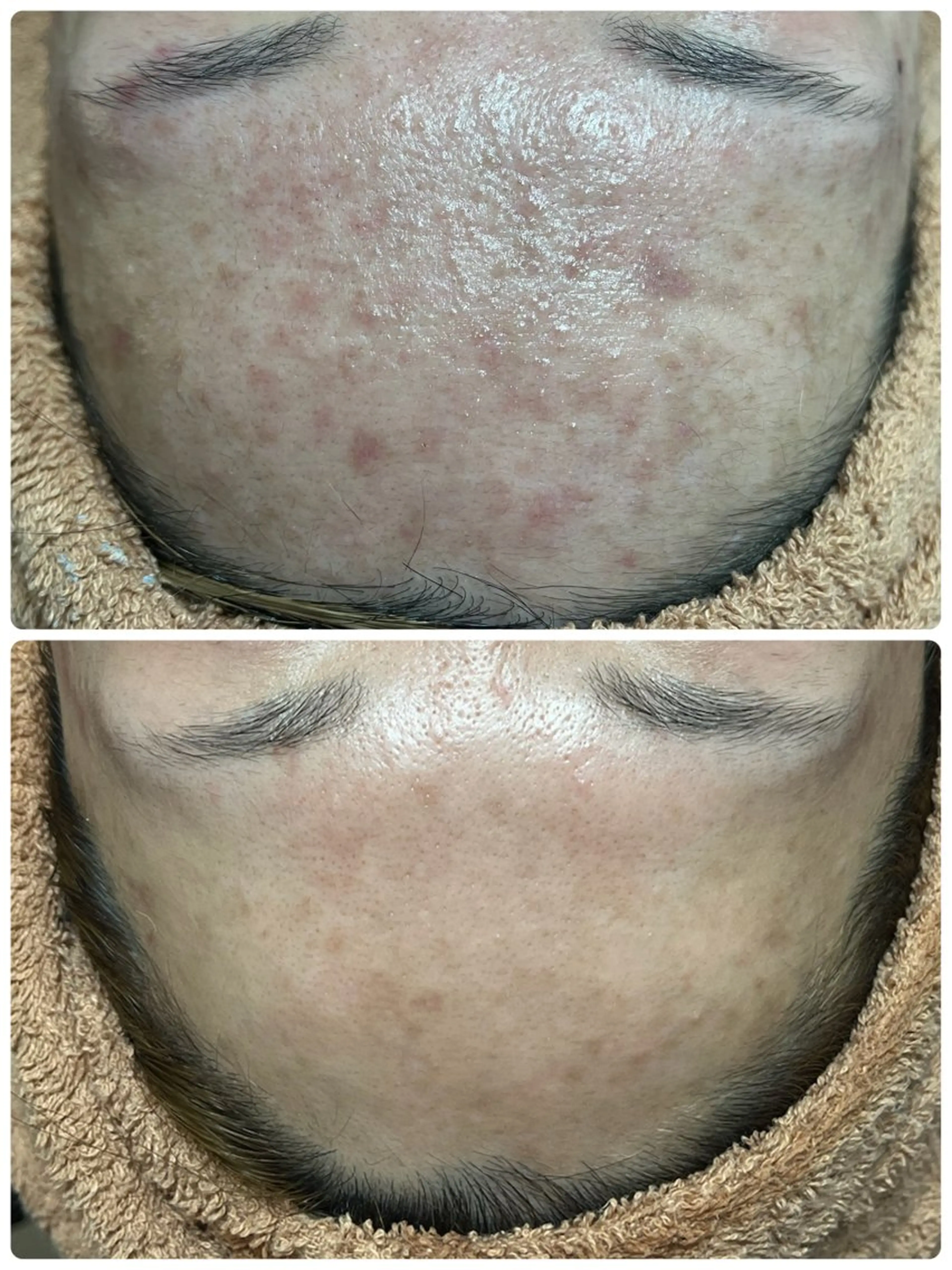 エステ beautysalon  LINO所属・平日昼間限定★ 全メニュ¥6600のエステ・リラクイメージ