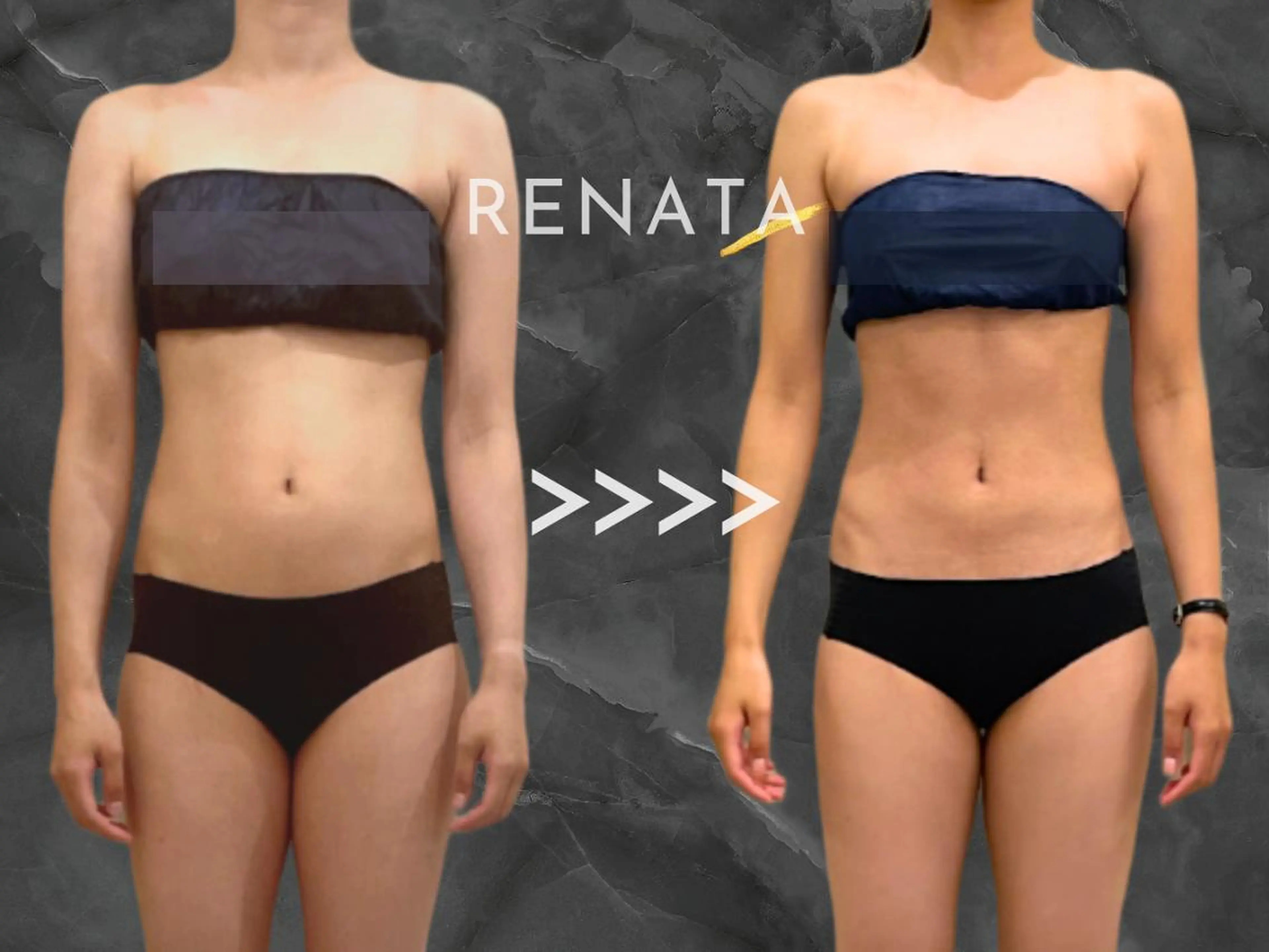 【期間限定】口コミ必須🌸冷却　お好きな部位8箇所モニターの写真