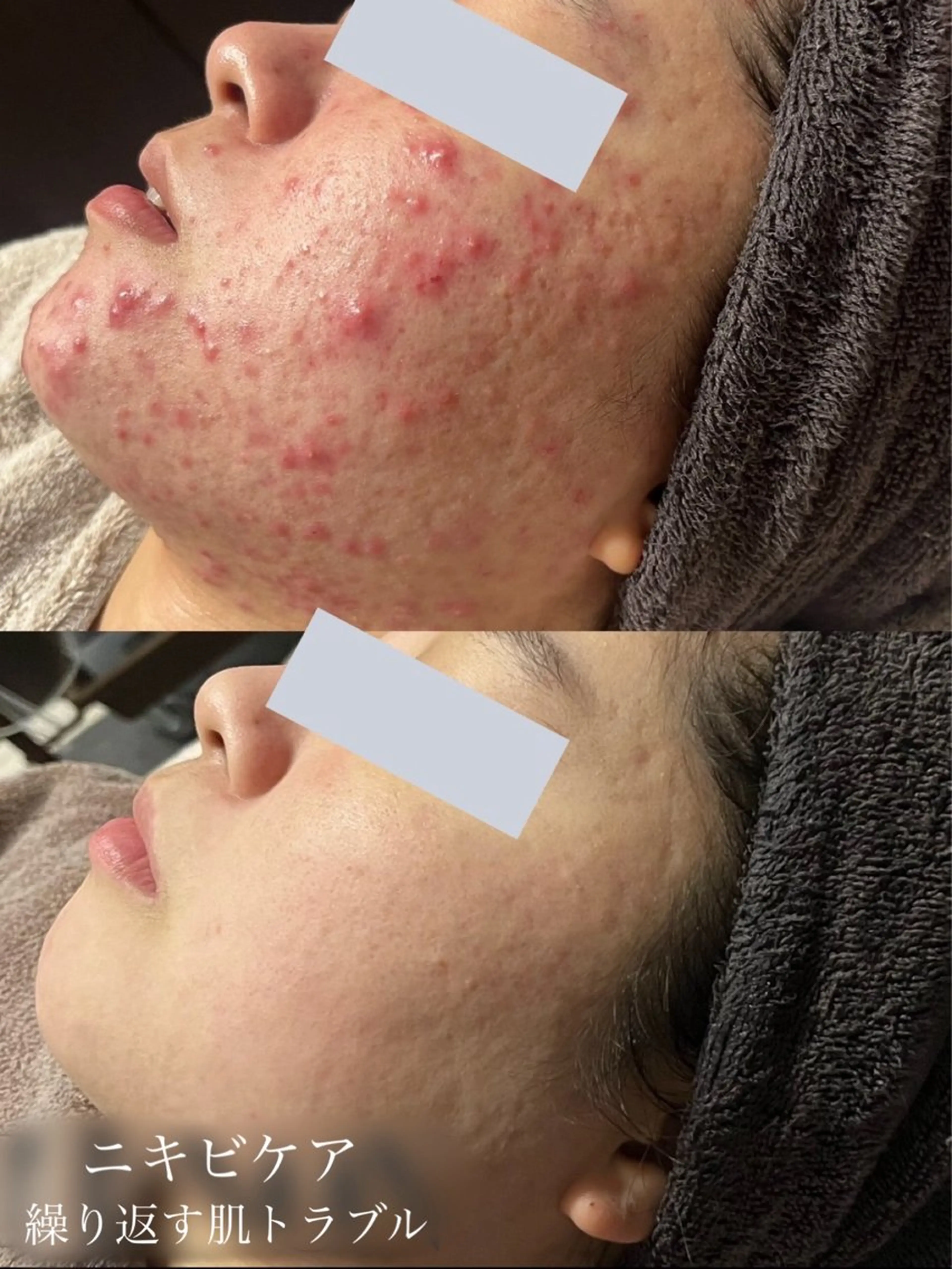 rejena 山口のエステ・リラクイメージ