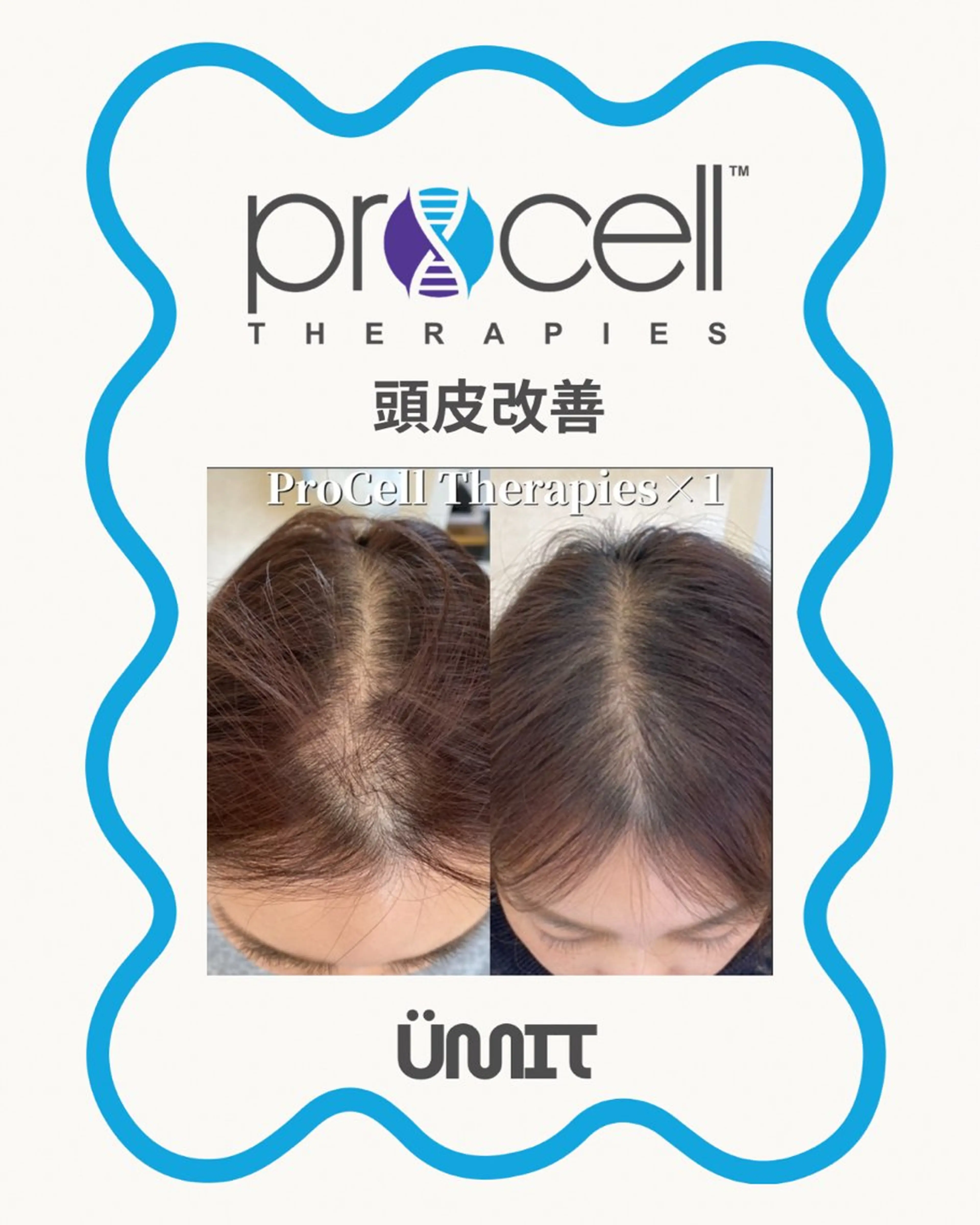 ヘッドスパ Ümit（ユミト） プロセルセラピーズのネイルデザイン