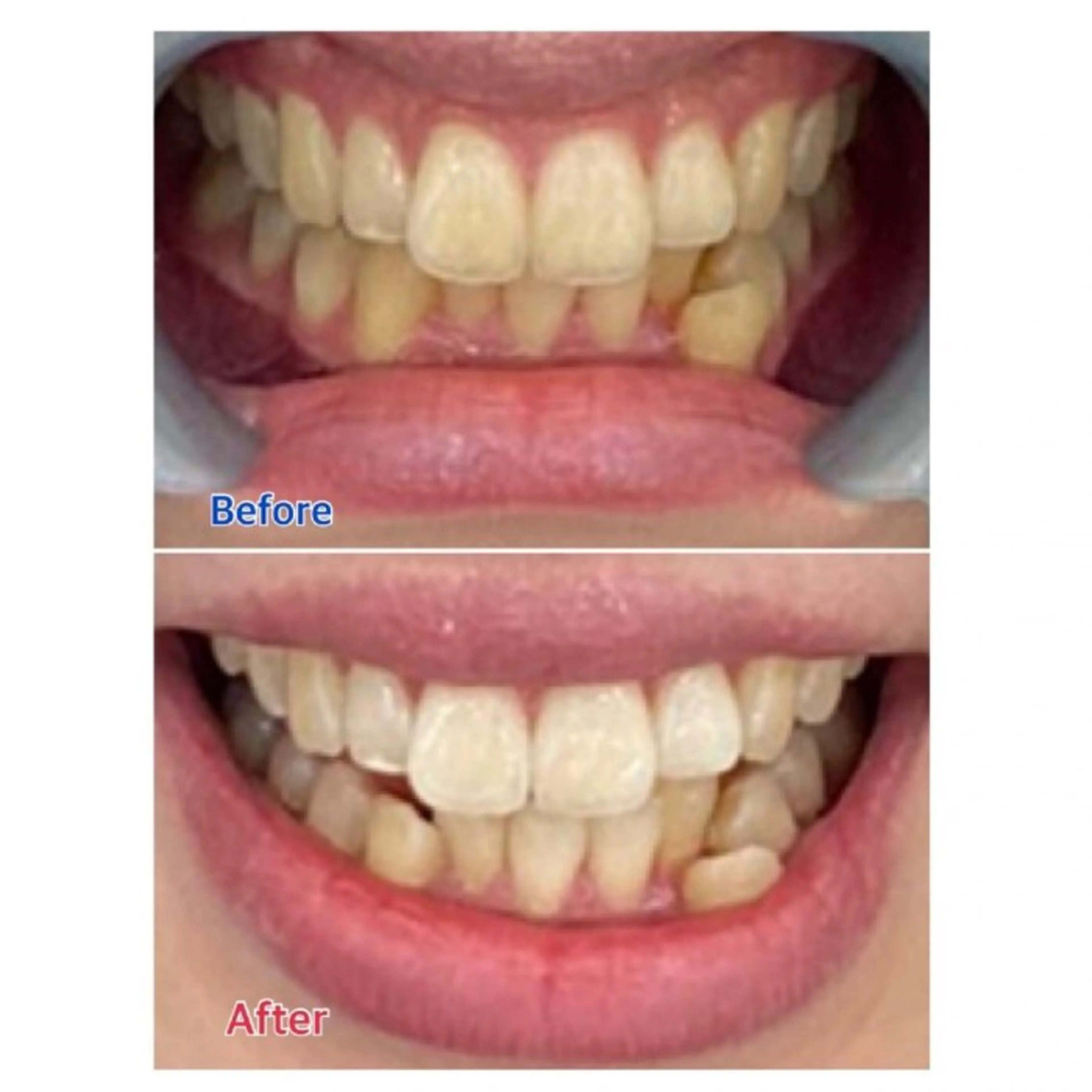 M渋谷店所属・Ｍ渋谷 ホワイトニングのその他イメージ