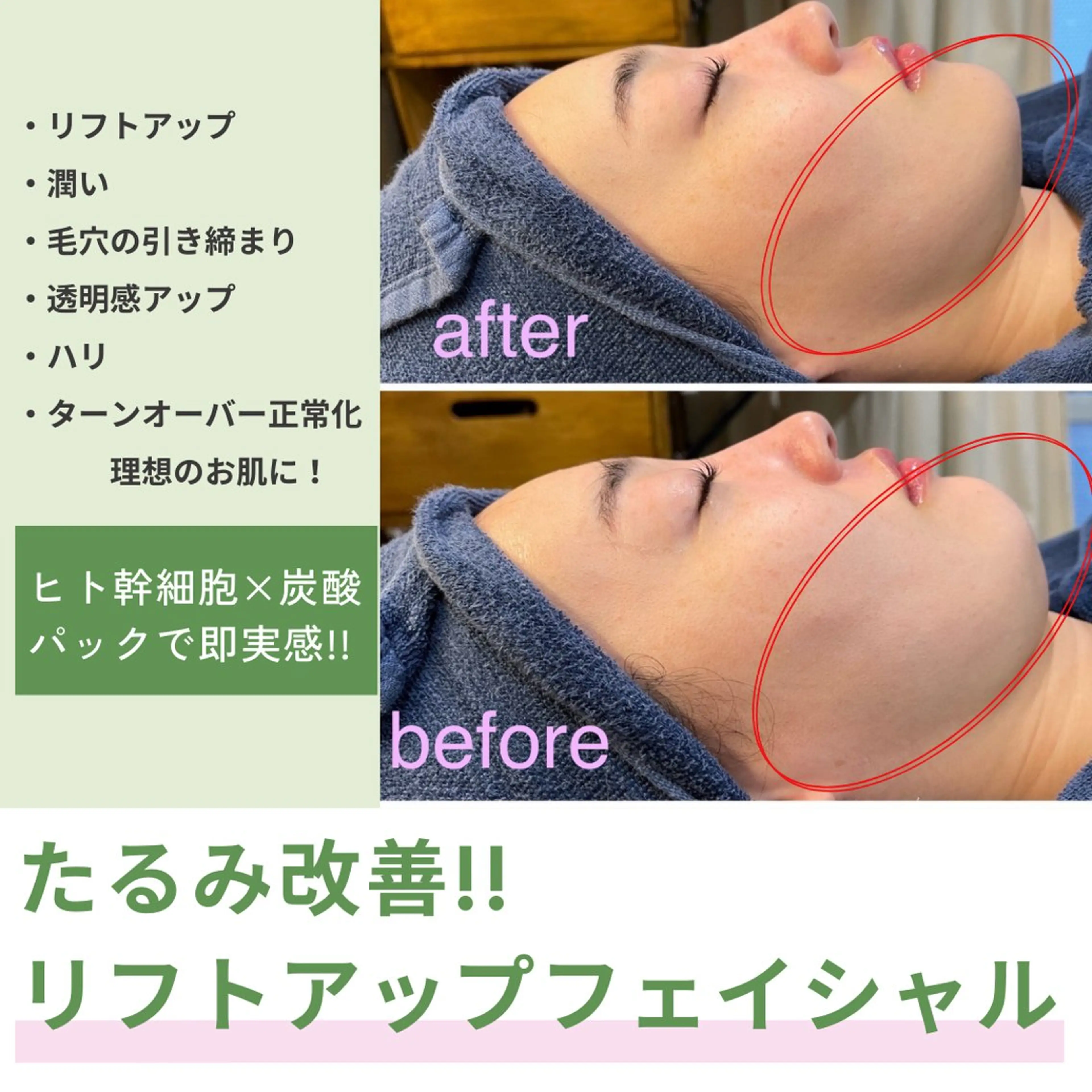 leolo武蔵浦和 肌質改善＆脱毛のエステ・リラクイメージ