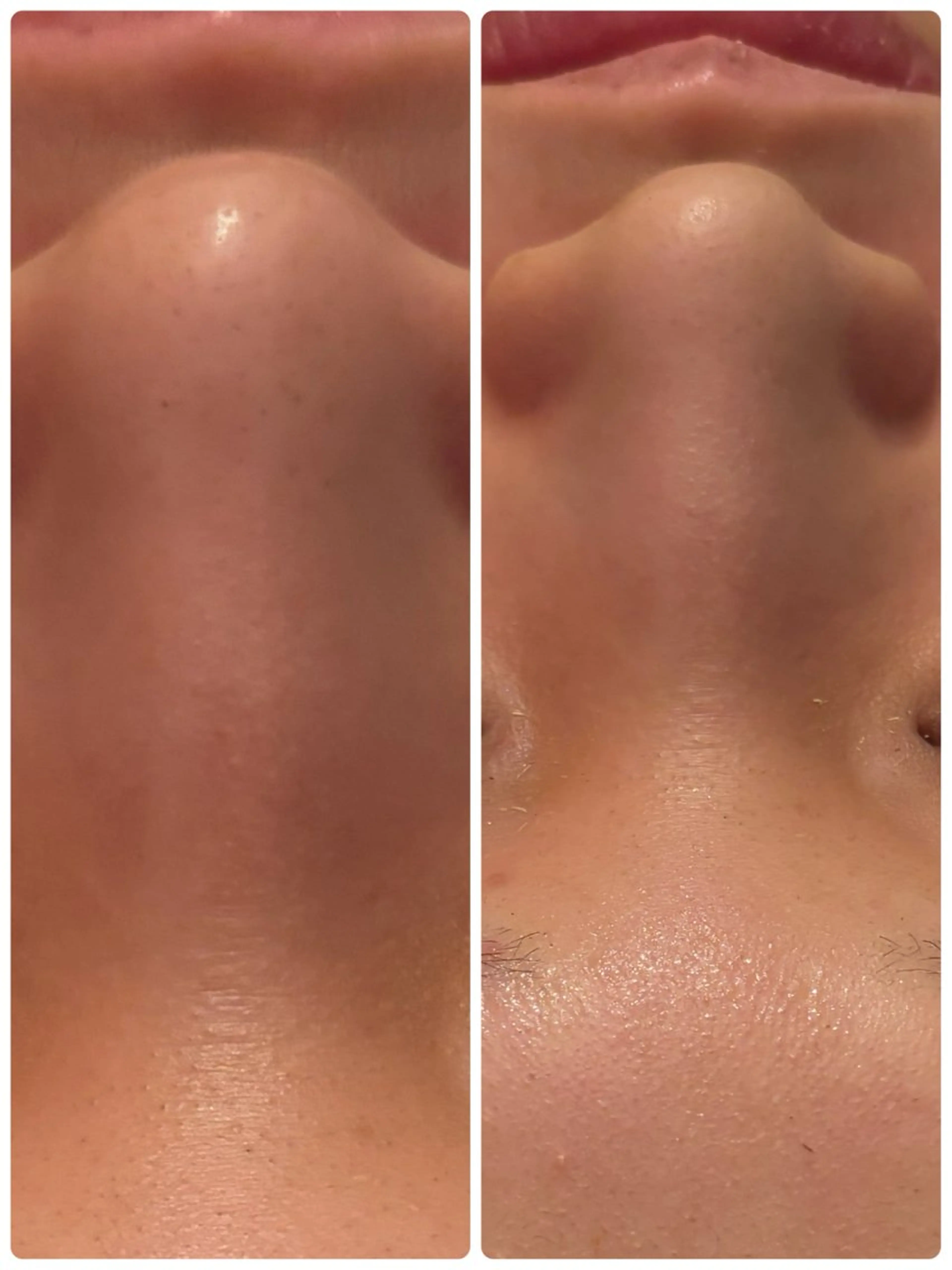 【Resetlab】 Chihiroのエステ・リラクイメージ