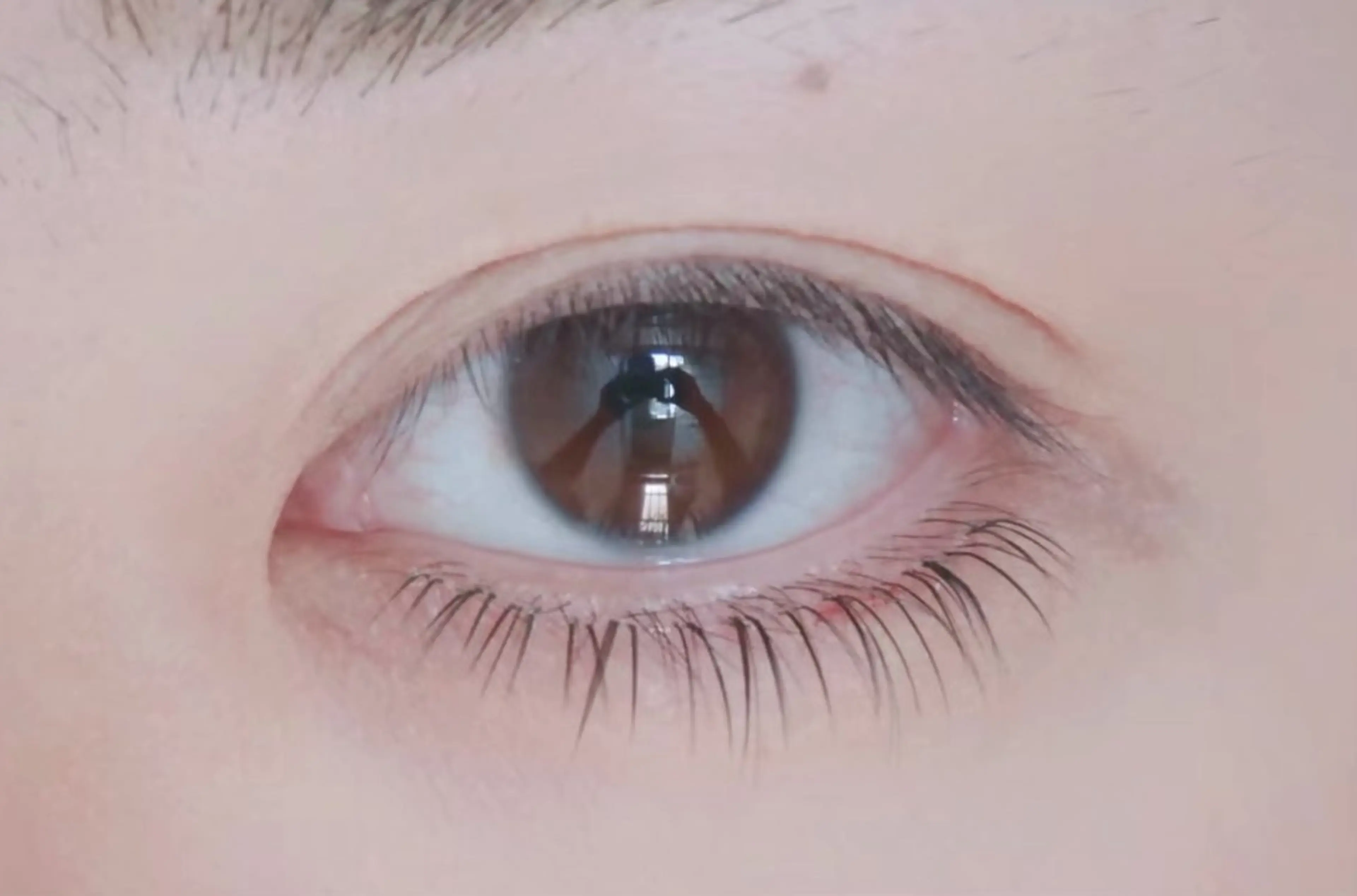 ✨下付け放題　アイパック付き✨の写真