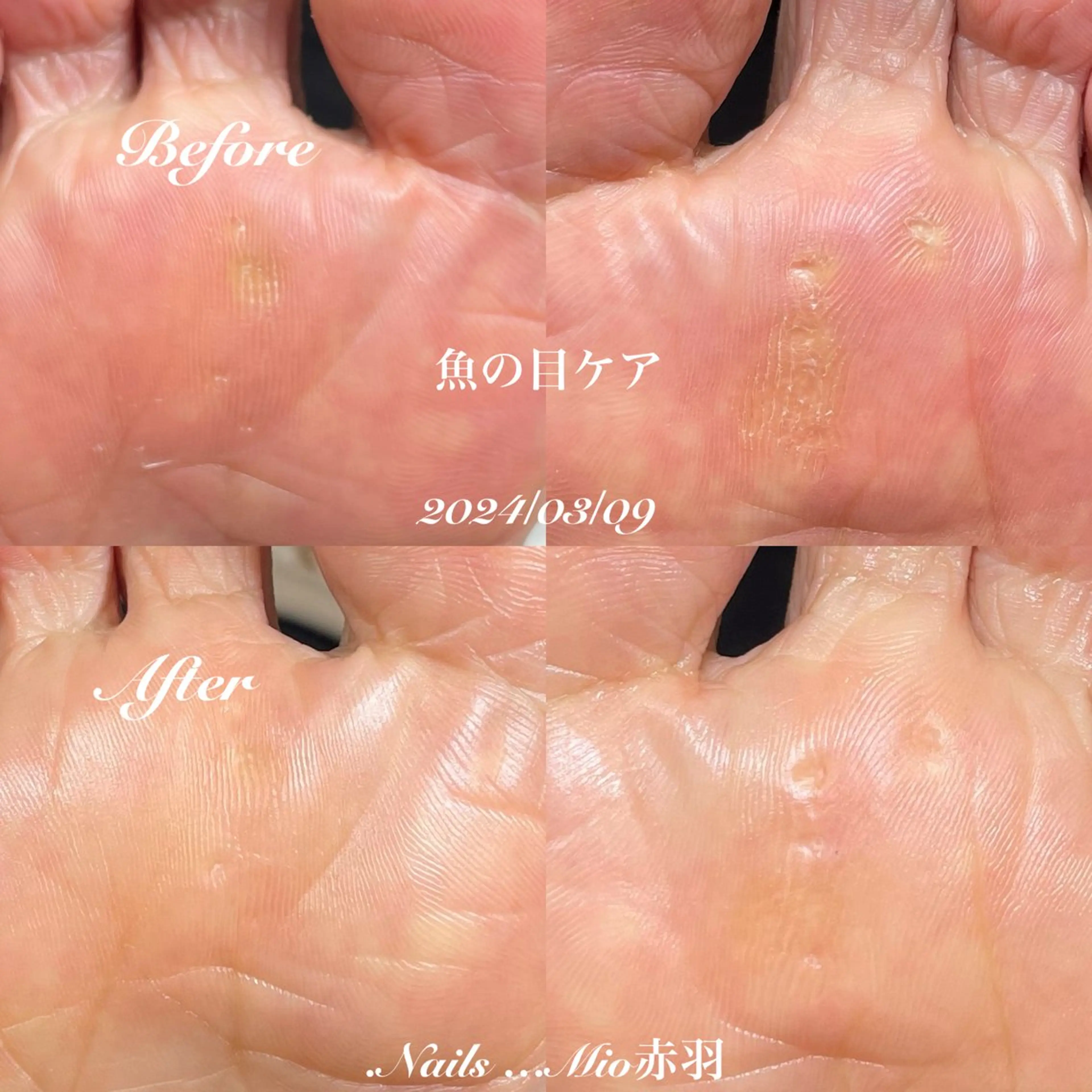 ネイル フットネイル .Nails Mio 赤羽西ネイルサロンのネイルデザイン