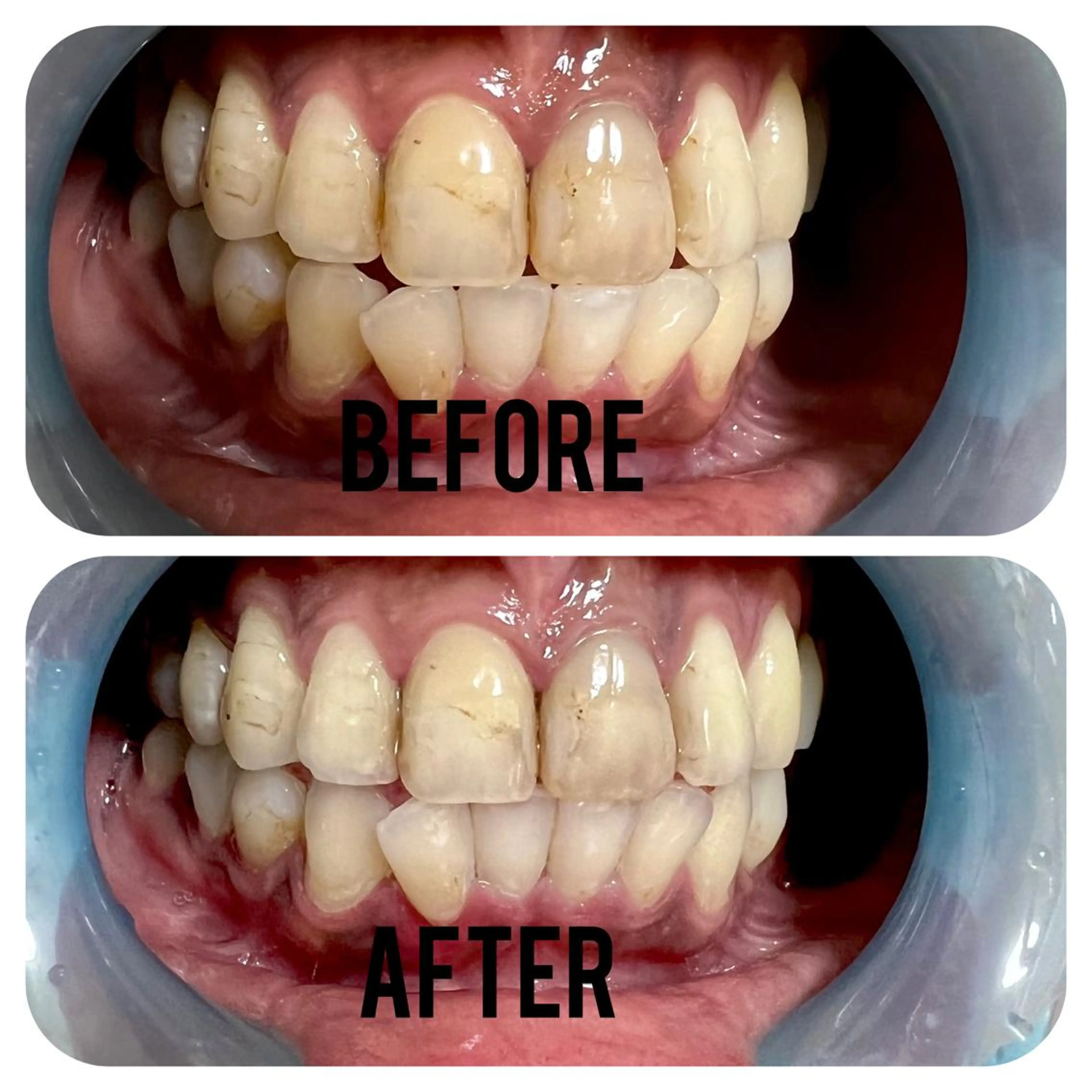 その他 two nailのネイルデザイン