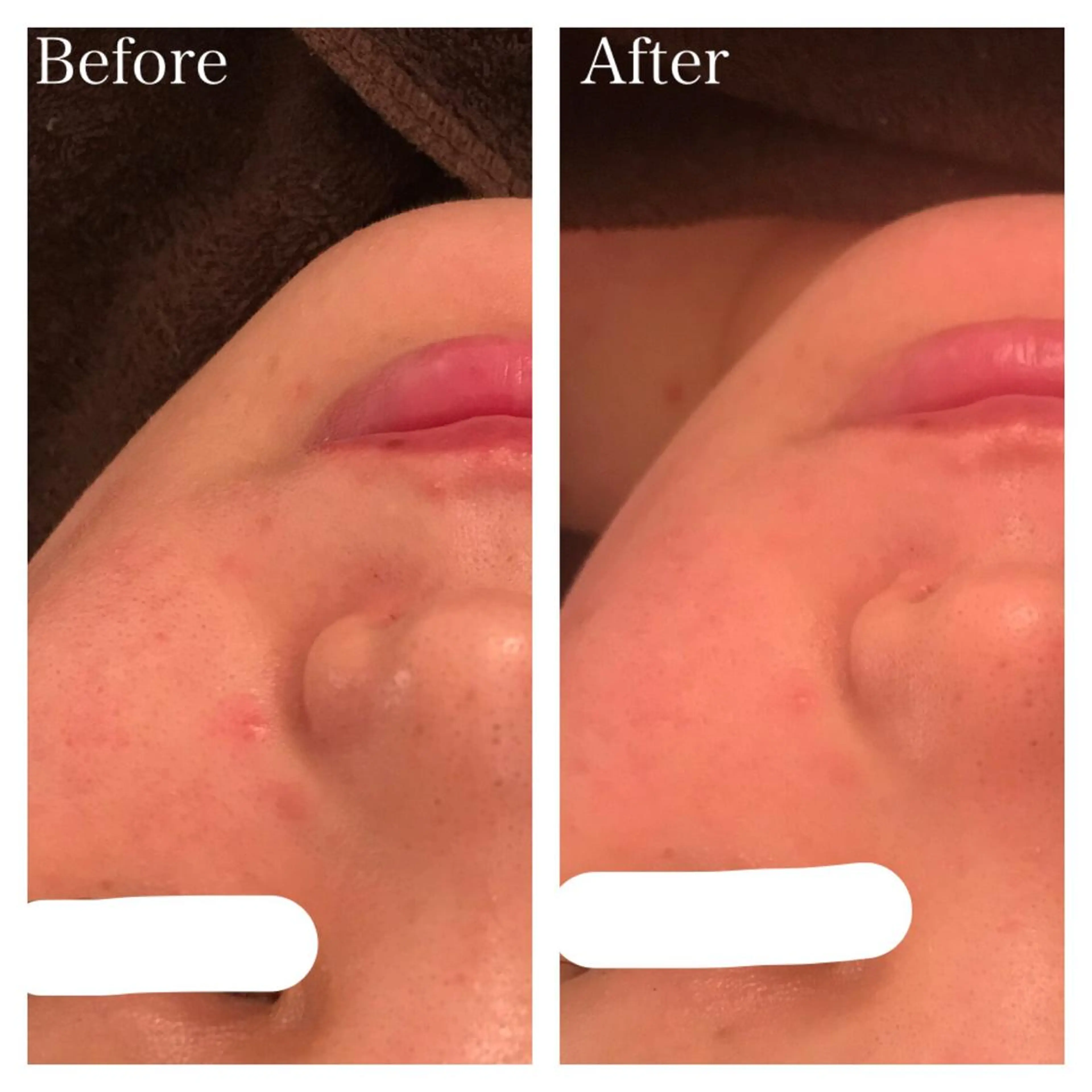 ミディアム カラー ネイル マツエク・マツパ ニキビ跡専門サロン Ａｉｎａのエステ・リラクイメージ