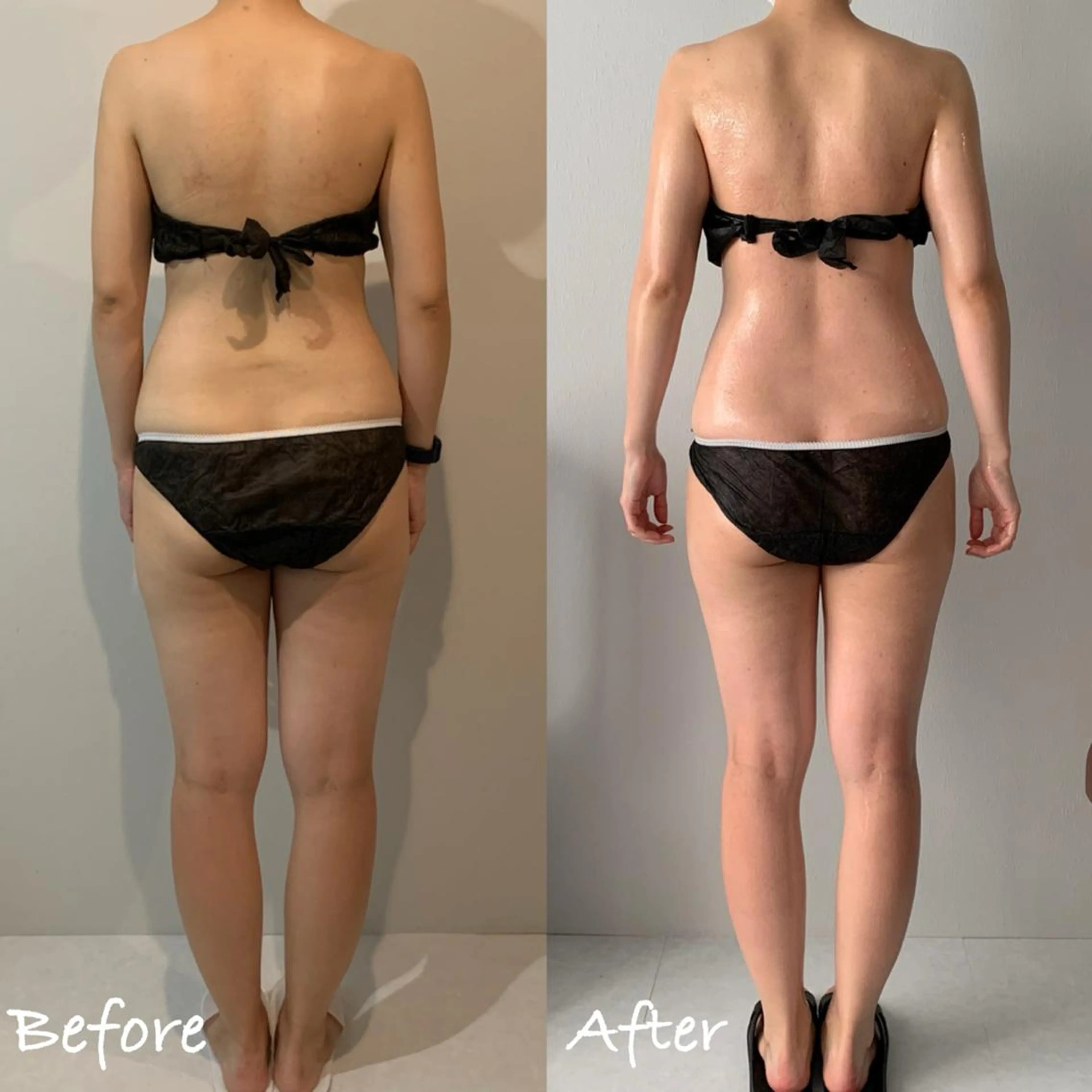 肩こり、浮腫、様々なお悩みの方やブライダルエステとしてもオススメ！オーダーメイド70分12100円→9900円の写真