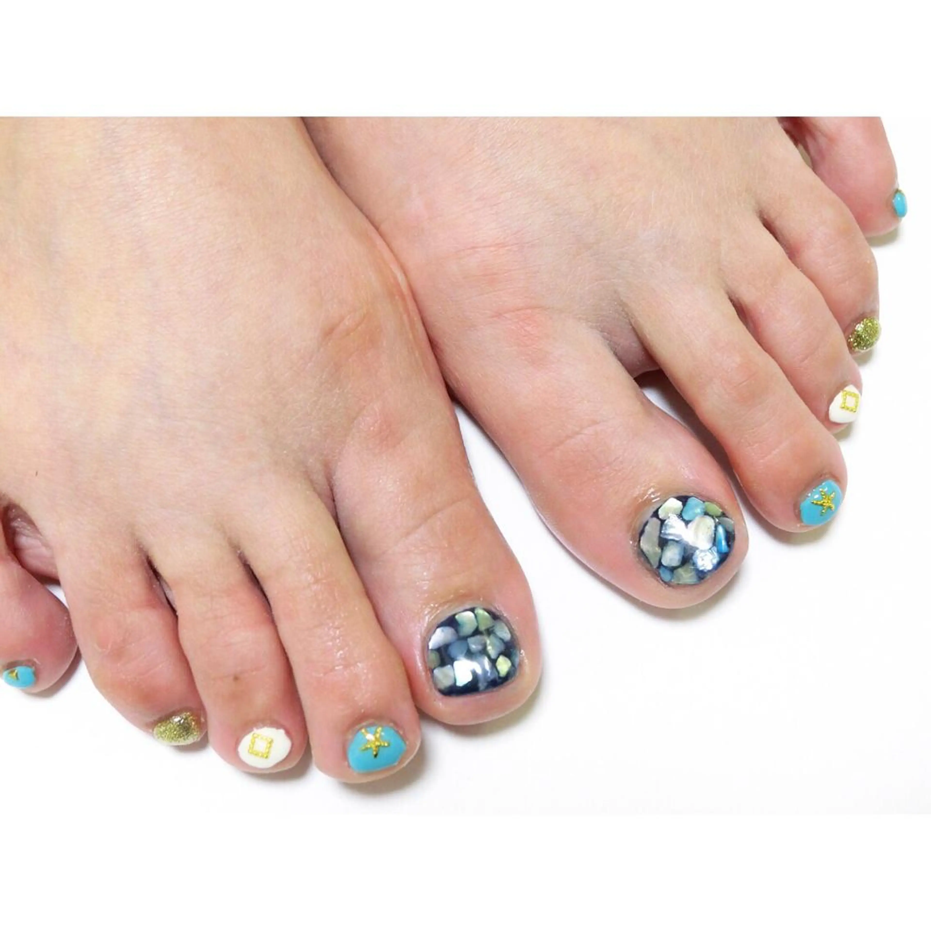 ネイル フットネイル 痛ネイル/ワンホン/ フィルイン/長さだしのネイルデザイン