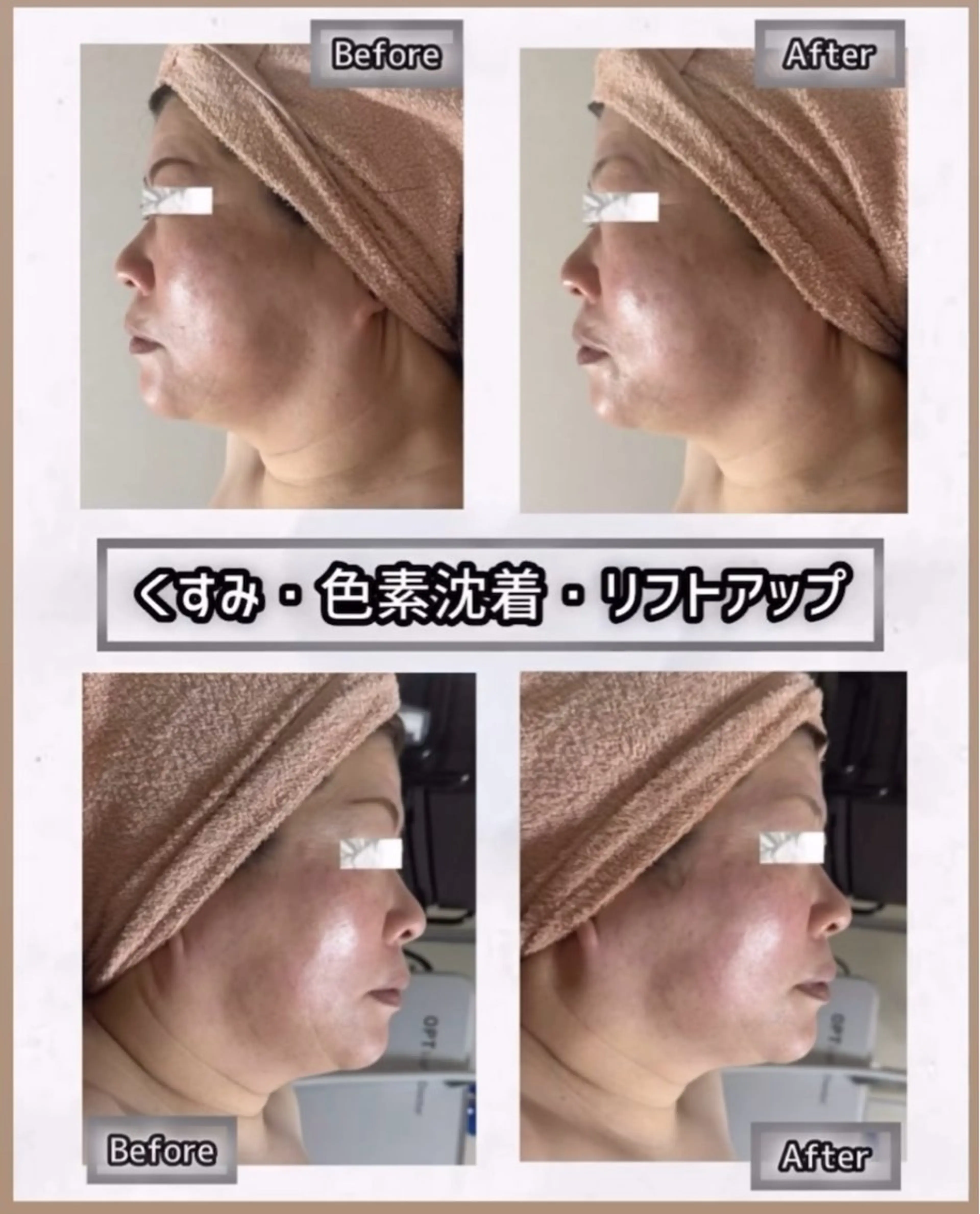 エステ ヴィーナス ビューティーのエステ・リラクイメージ