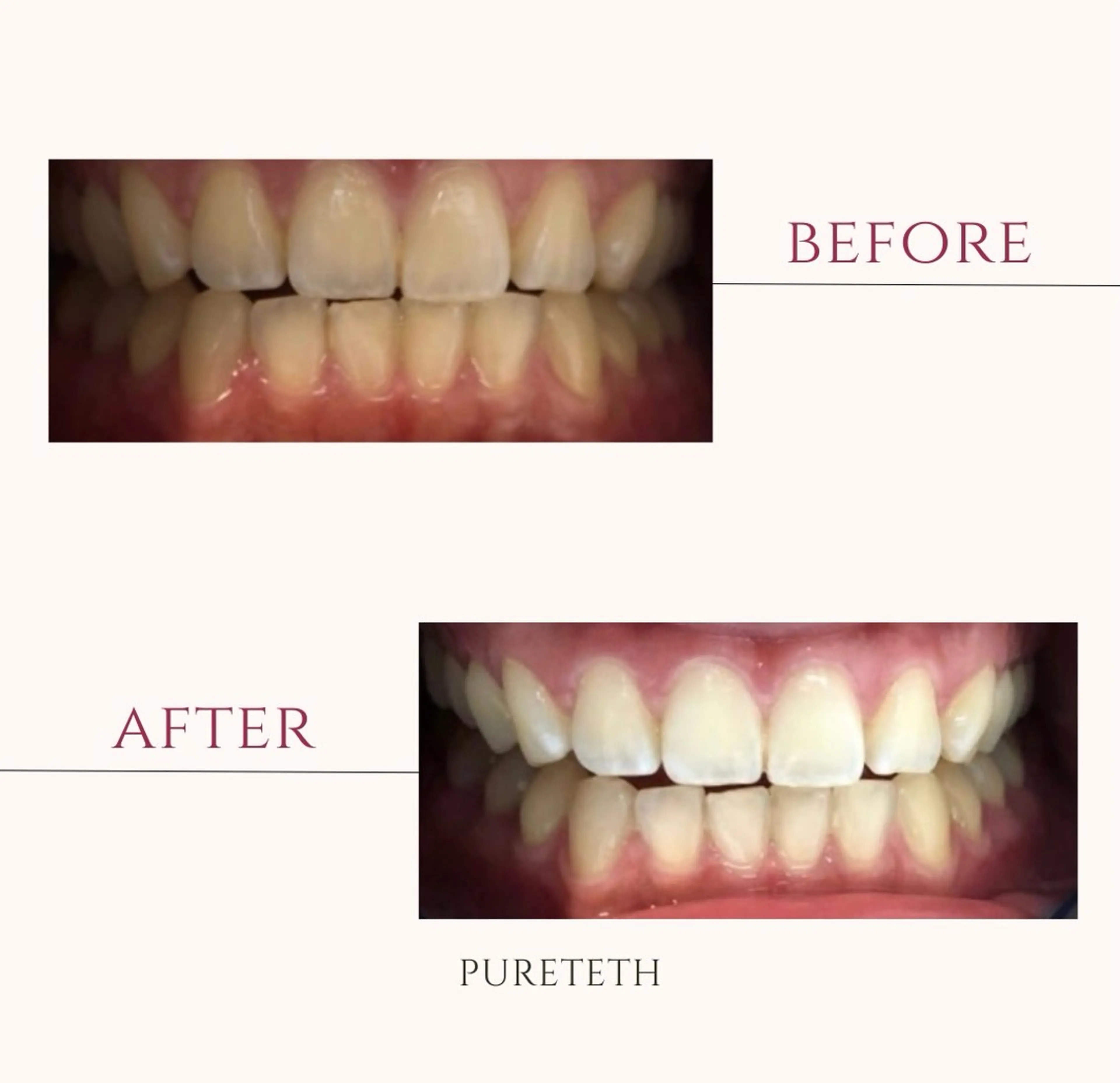 エステ ホワイトニングサロンPURETETH所属・ホワイトニングサロン PURETETHのエステ・リラクイメージ