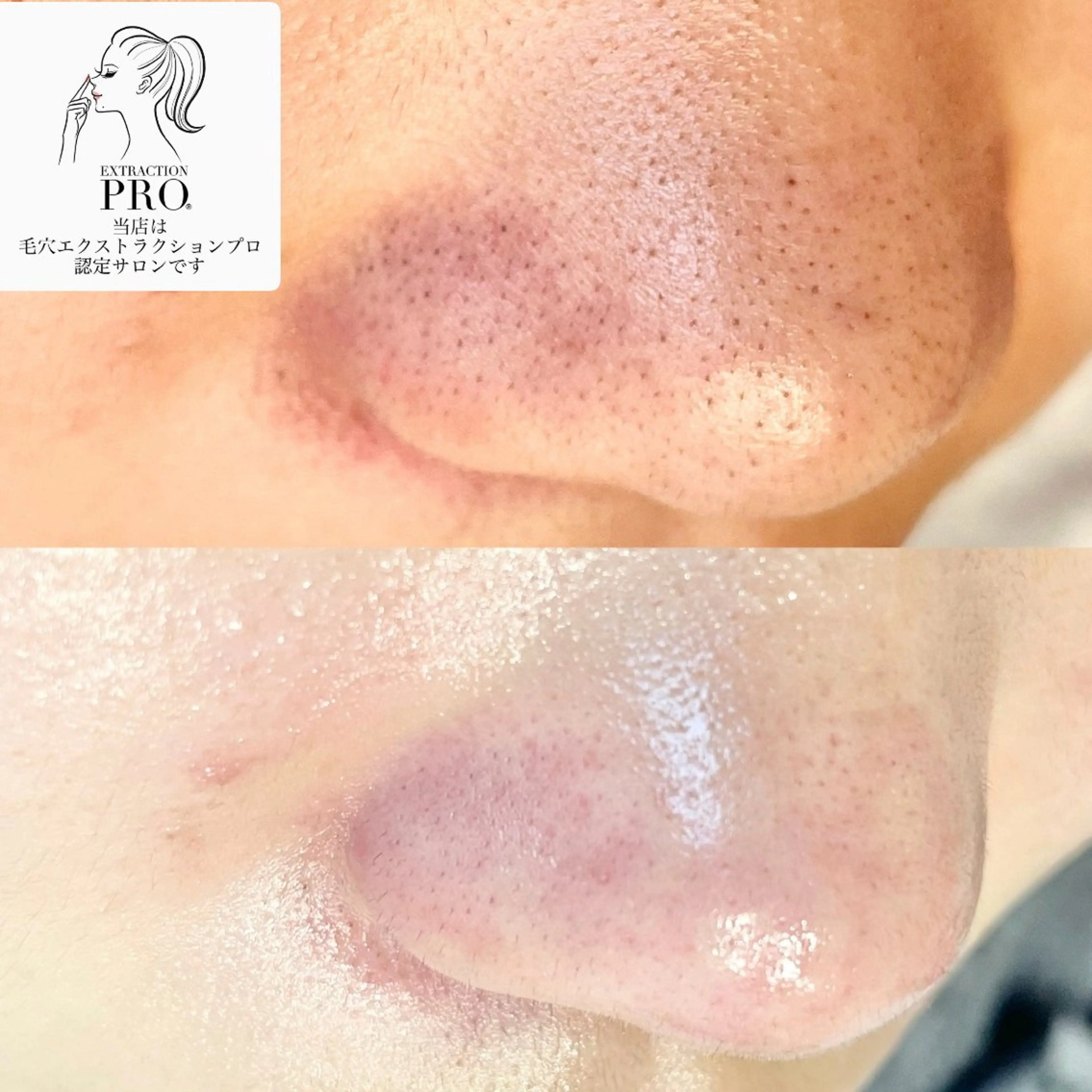 エステ アイラッシュサロン CoCoのマツエク・マツパデザイン