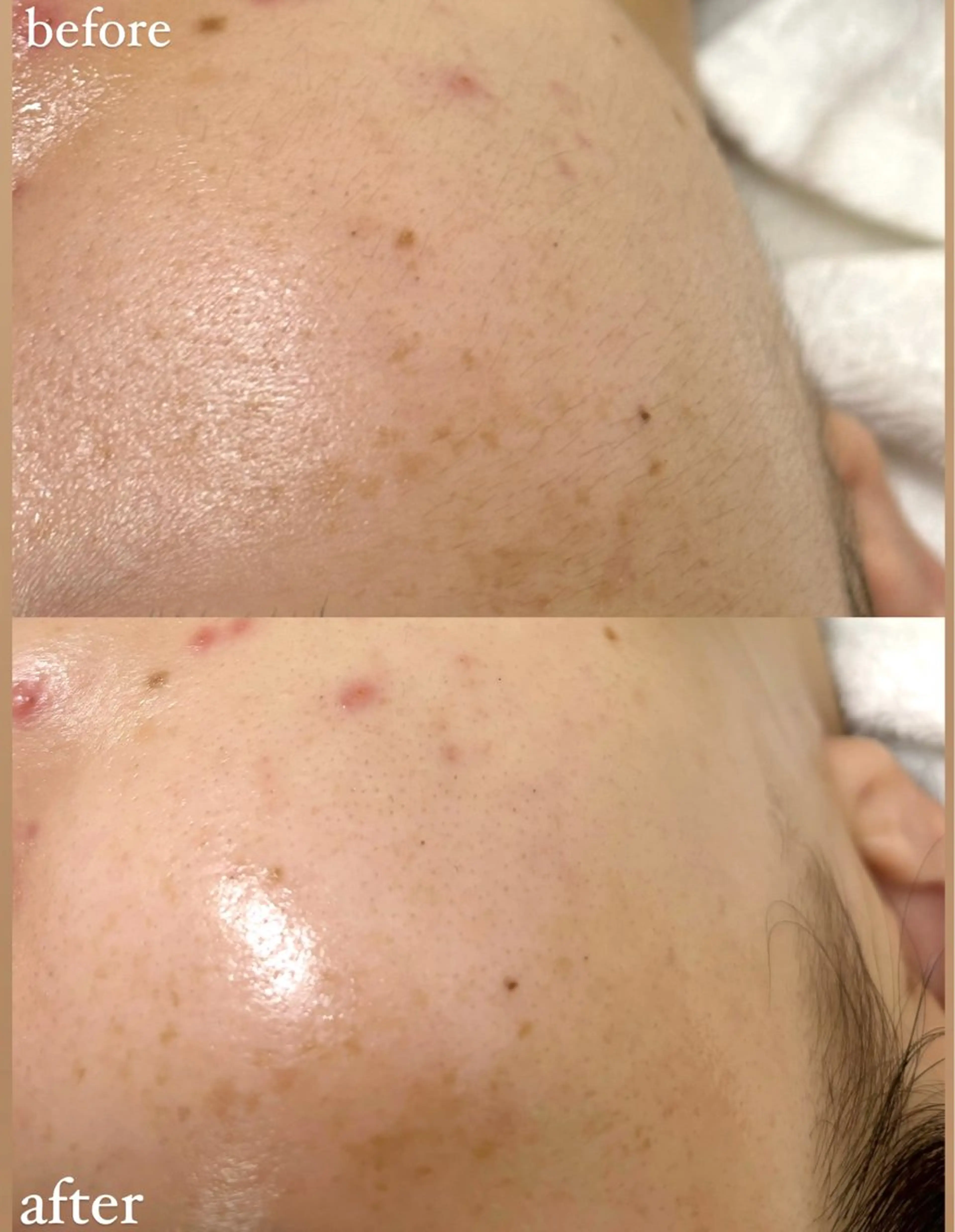 女性専門お顔剃り sunraineのエステ・リラクイメージ