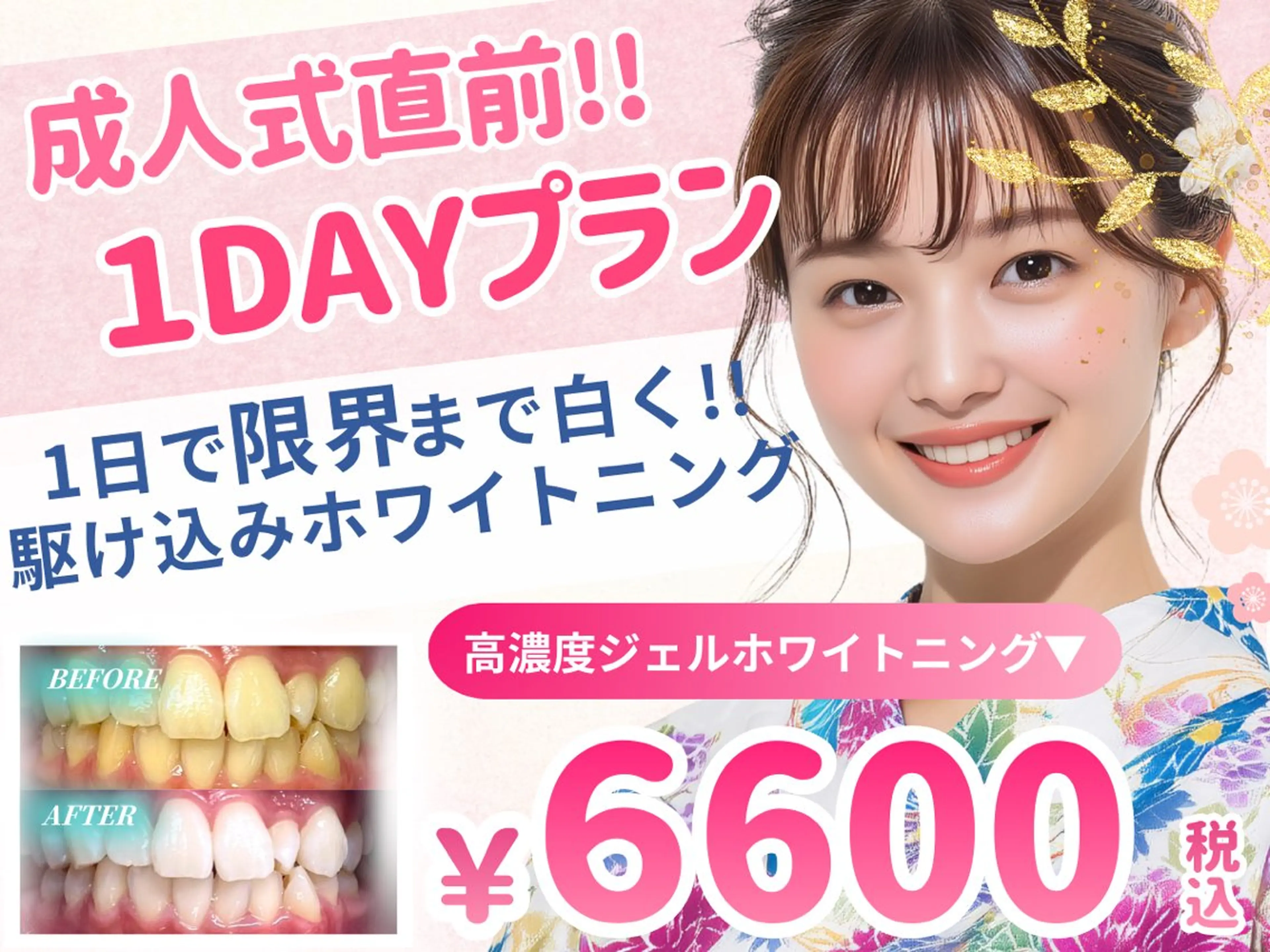 新成人限定【先着3名様限定】1dayスペシャルプラン🌟ワンランク上のハイパワーホワイトニングで1日で限界まで白く‼️の写真