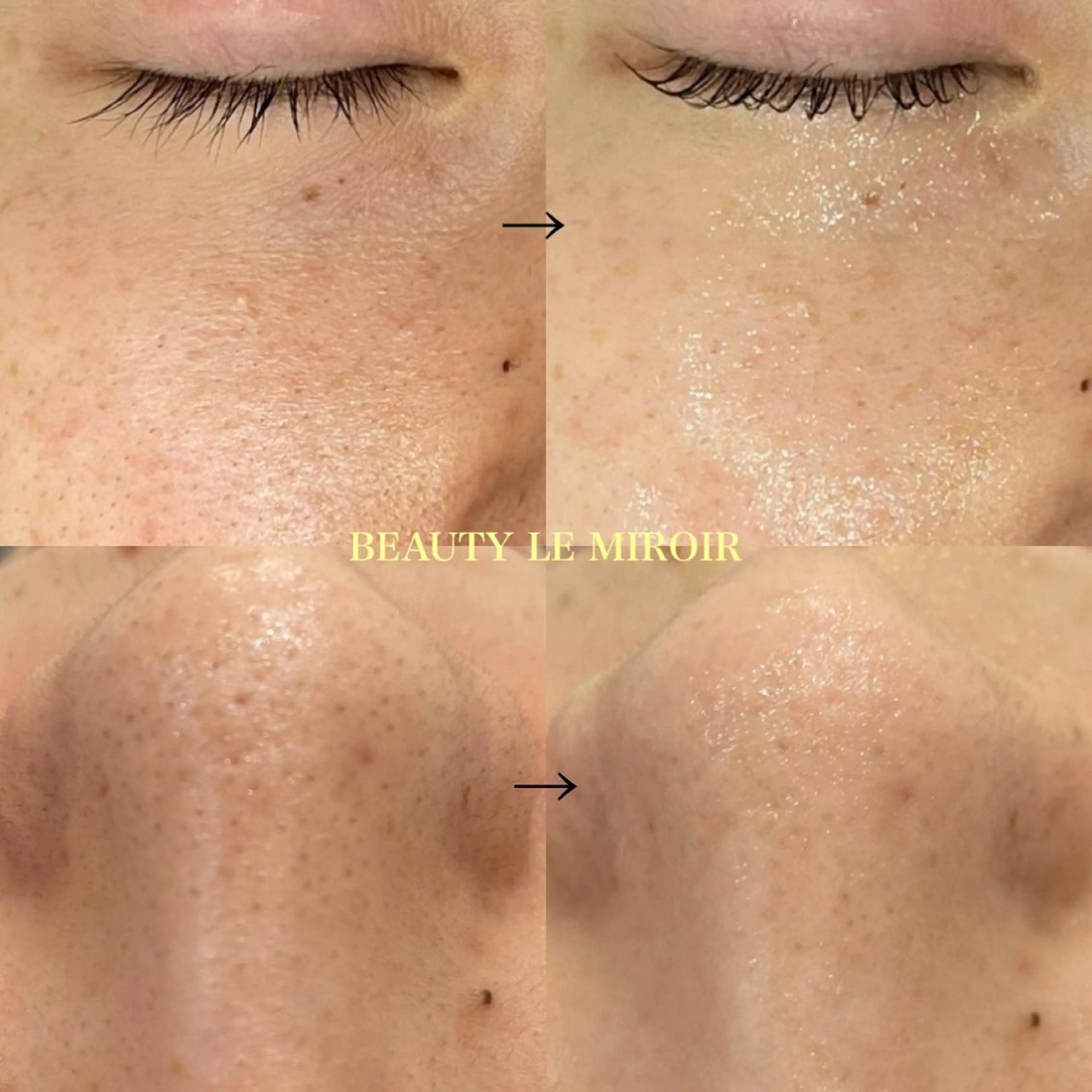 ビューティー ミロワールのエステ・リラクイメージ