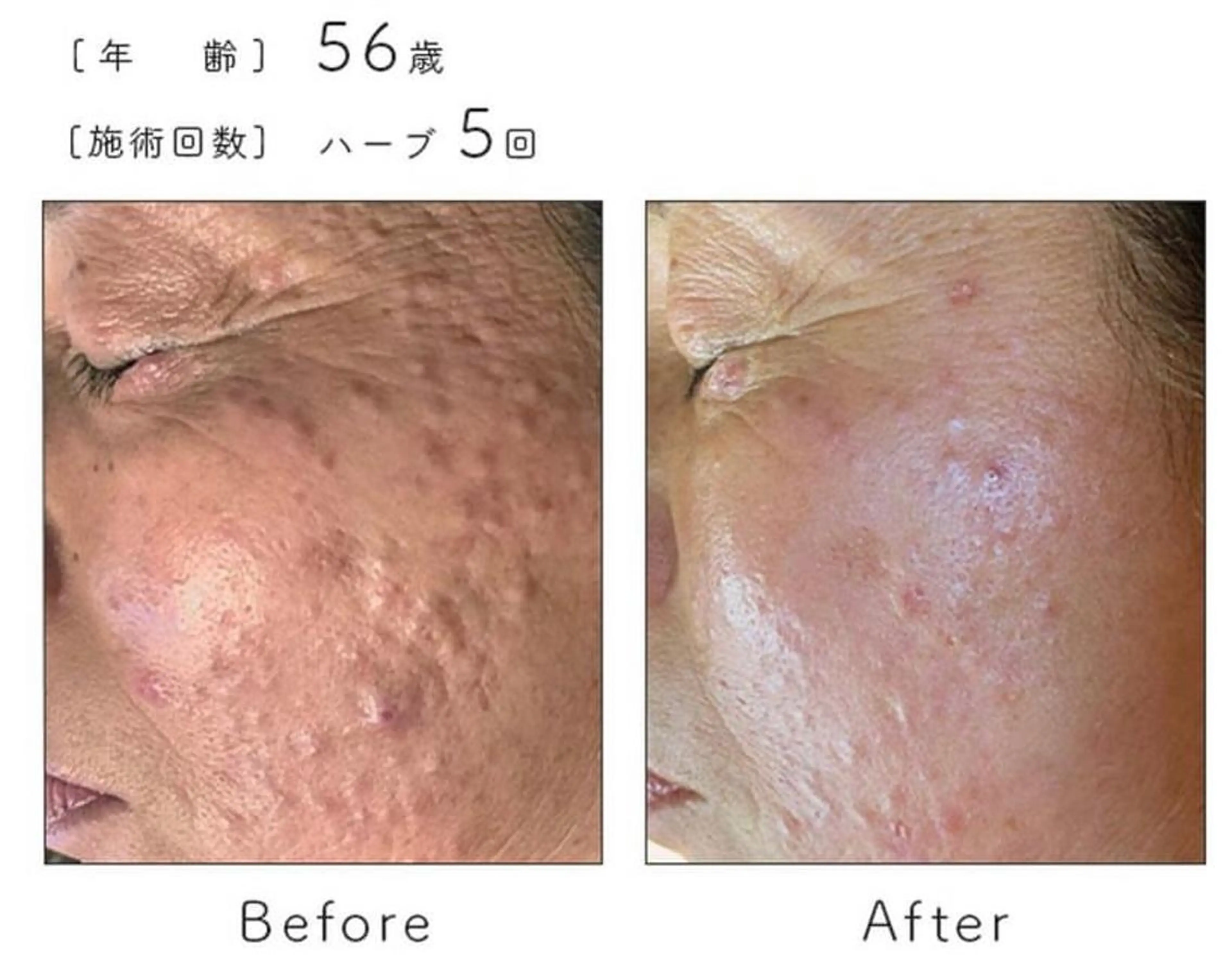 エステ ハーブピーリング専門 BIOPLUS＋川崎のエステ・リラクイメージ