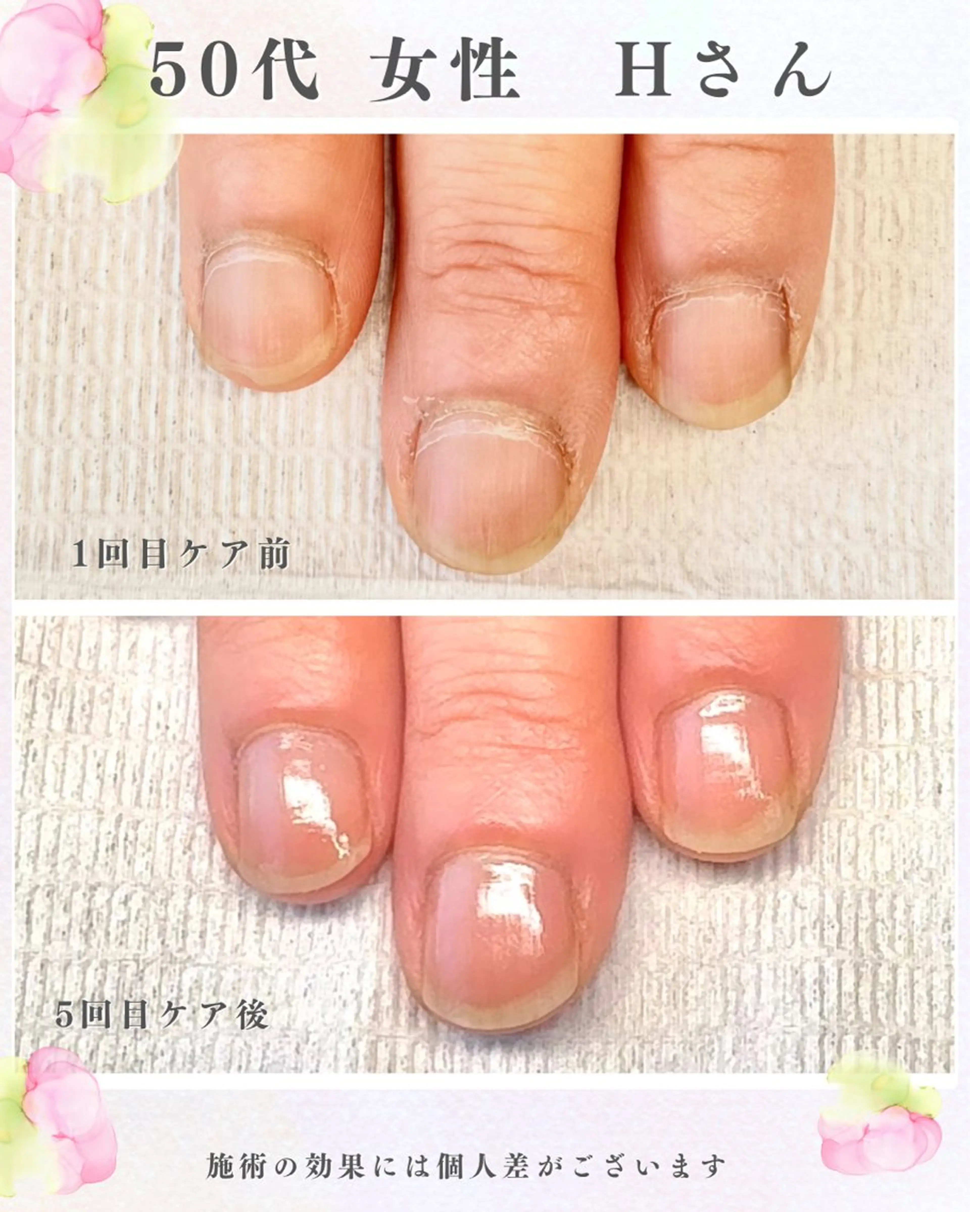 【地爪育成】最強のネイルケア1回体験。通常8,000円ですが、ミニモ特別価格で5,500円の写真