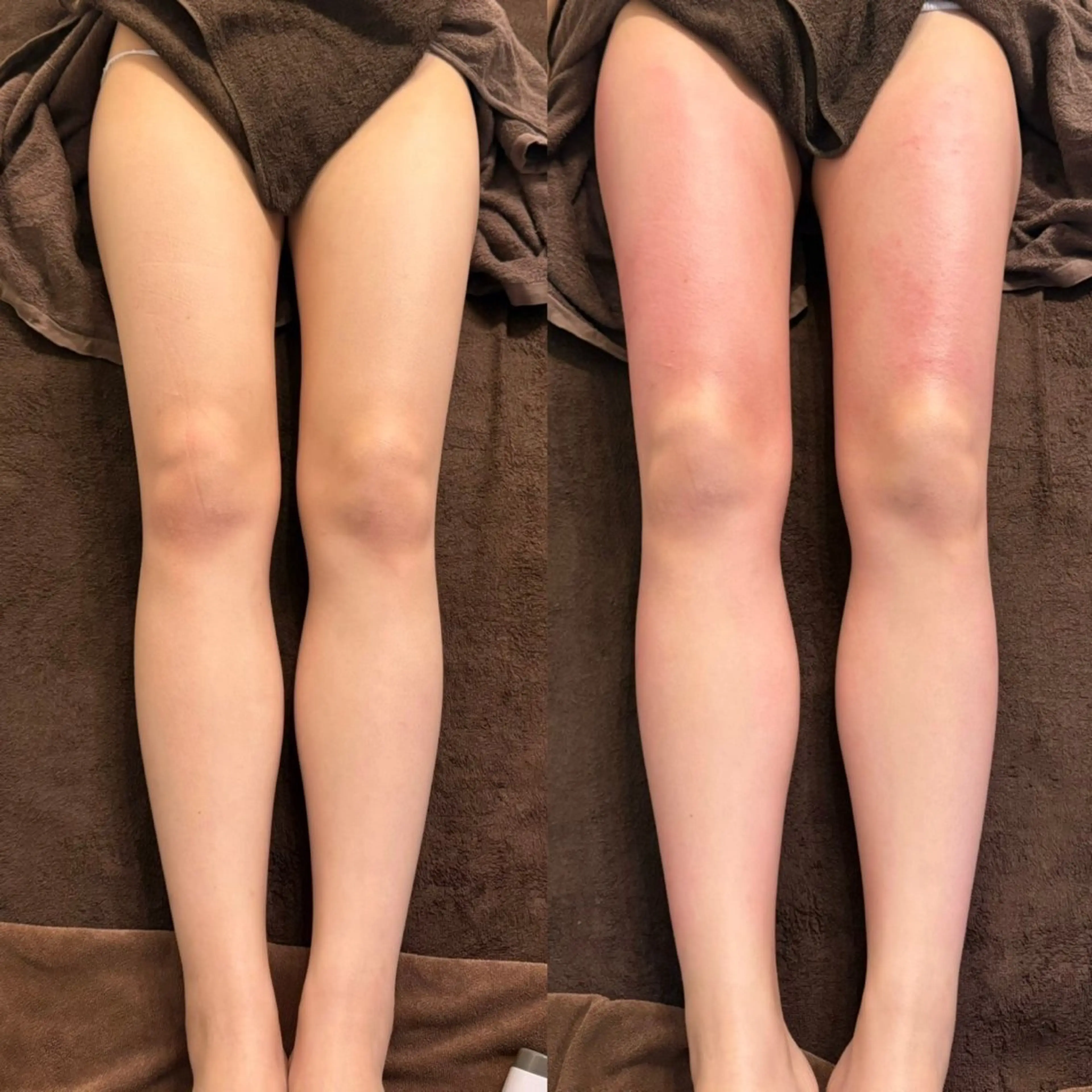 エステ セルフエステエンリケ明石大久保店所属・夕希リンパ&痩身& 脱毛&毛穴ケアのエステ・リラクイメージ