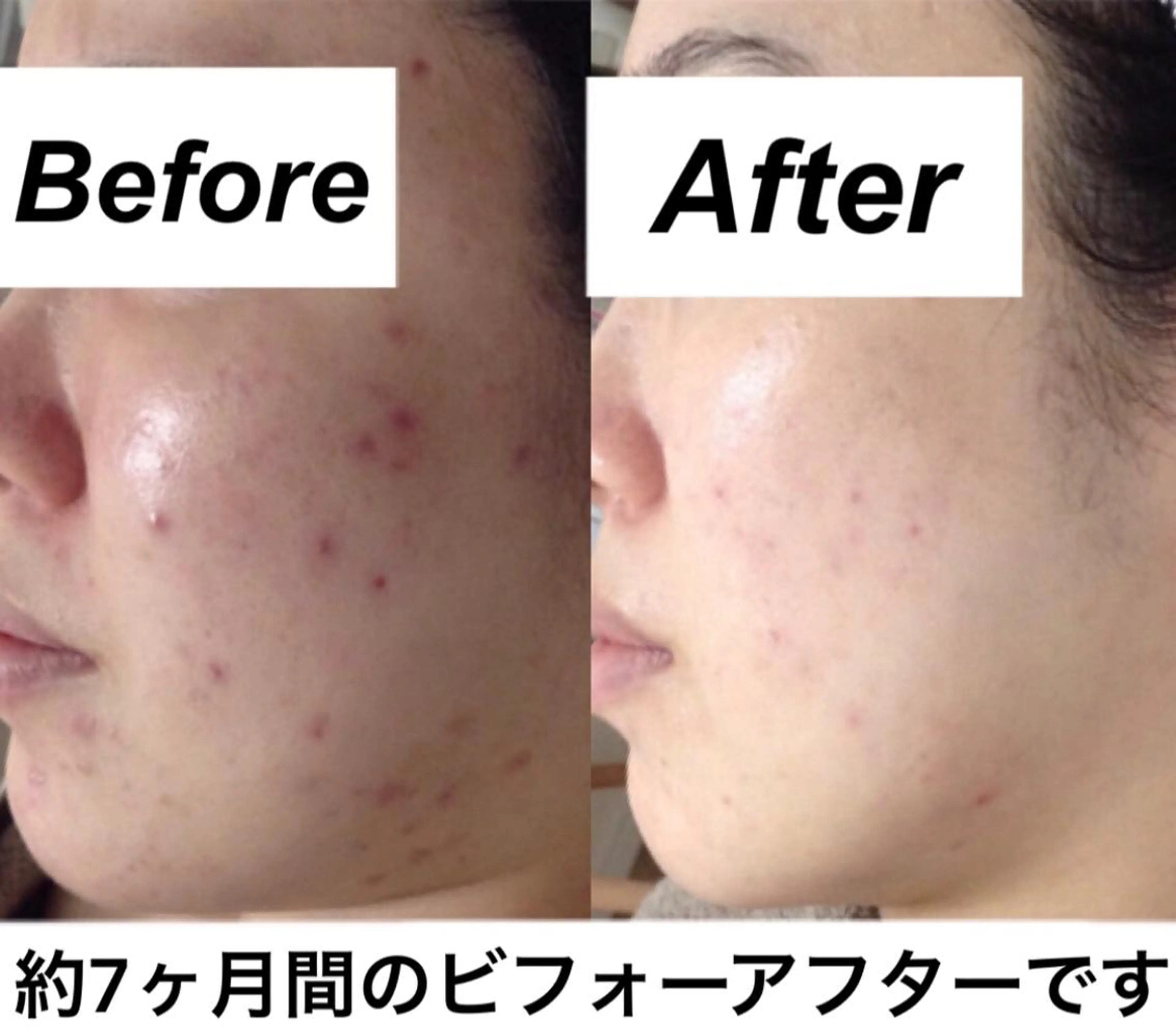 エステ リラク 都度払い肌質改善 &脱毛Blancheのエステ・リラクイメージ