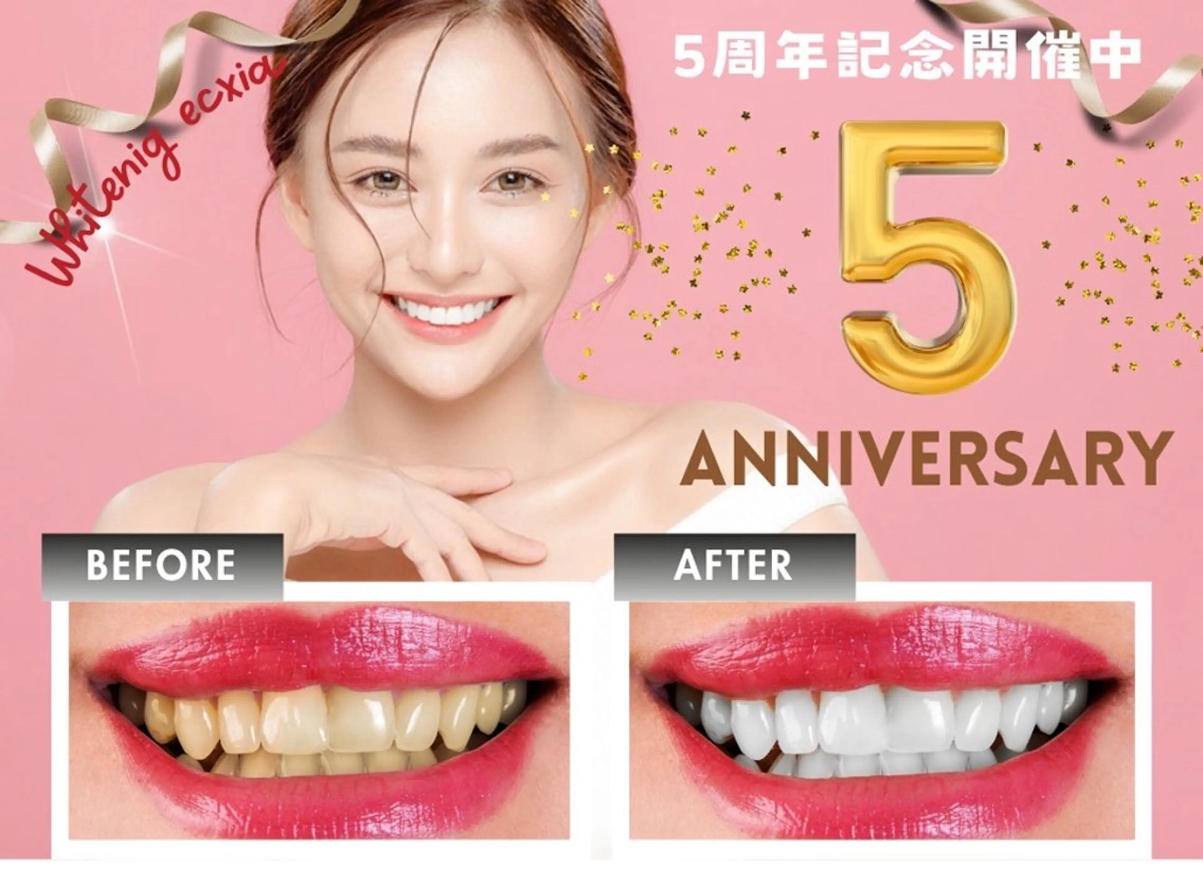 セルフホワイトニング エクシア徳島店マユのその他イメージ