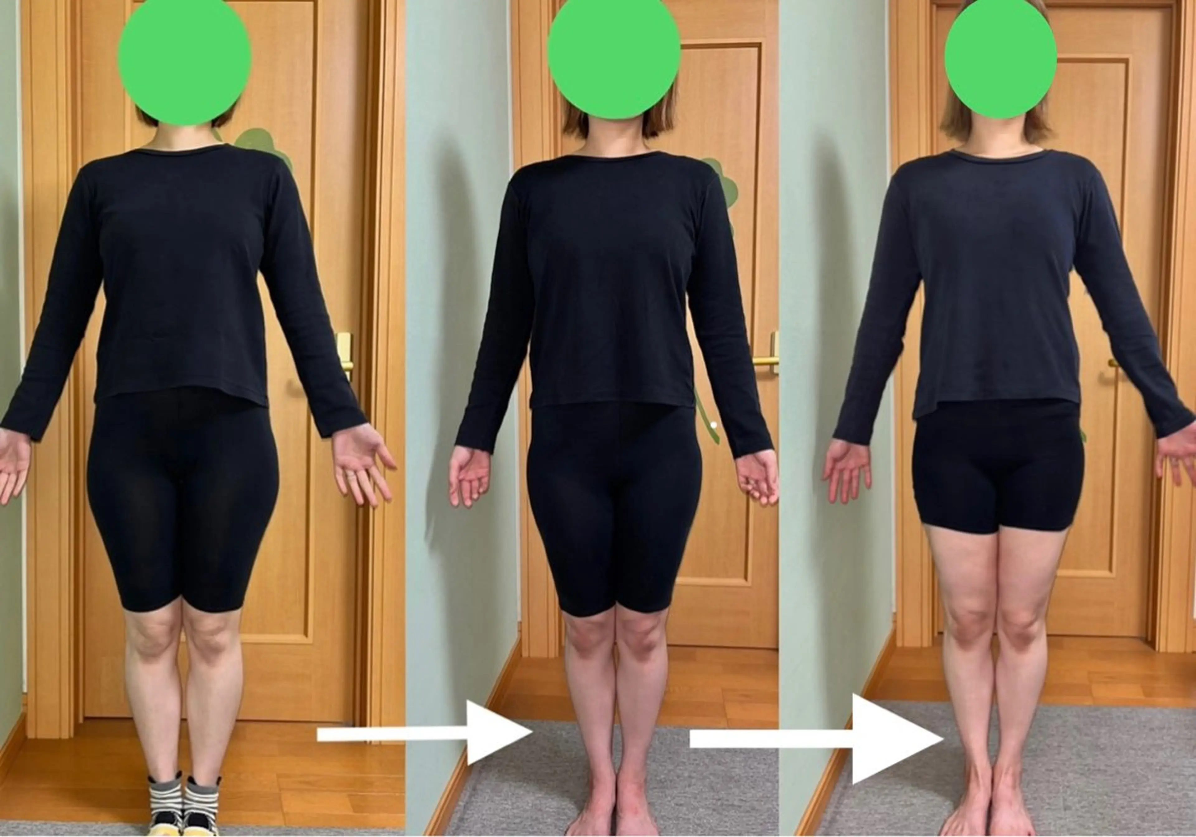 大転子スッキリ小尻化へ！骨盤矯正 60分 5500円の写真