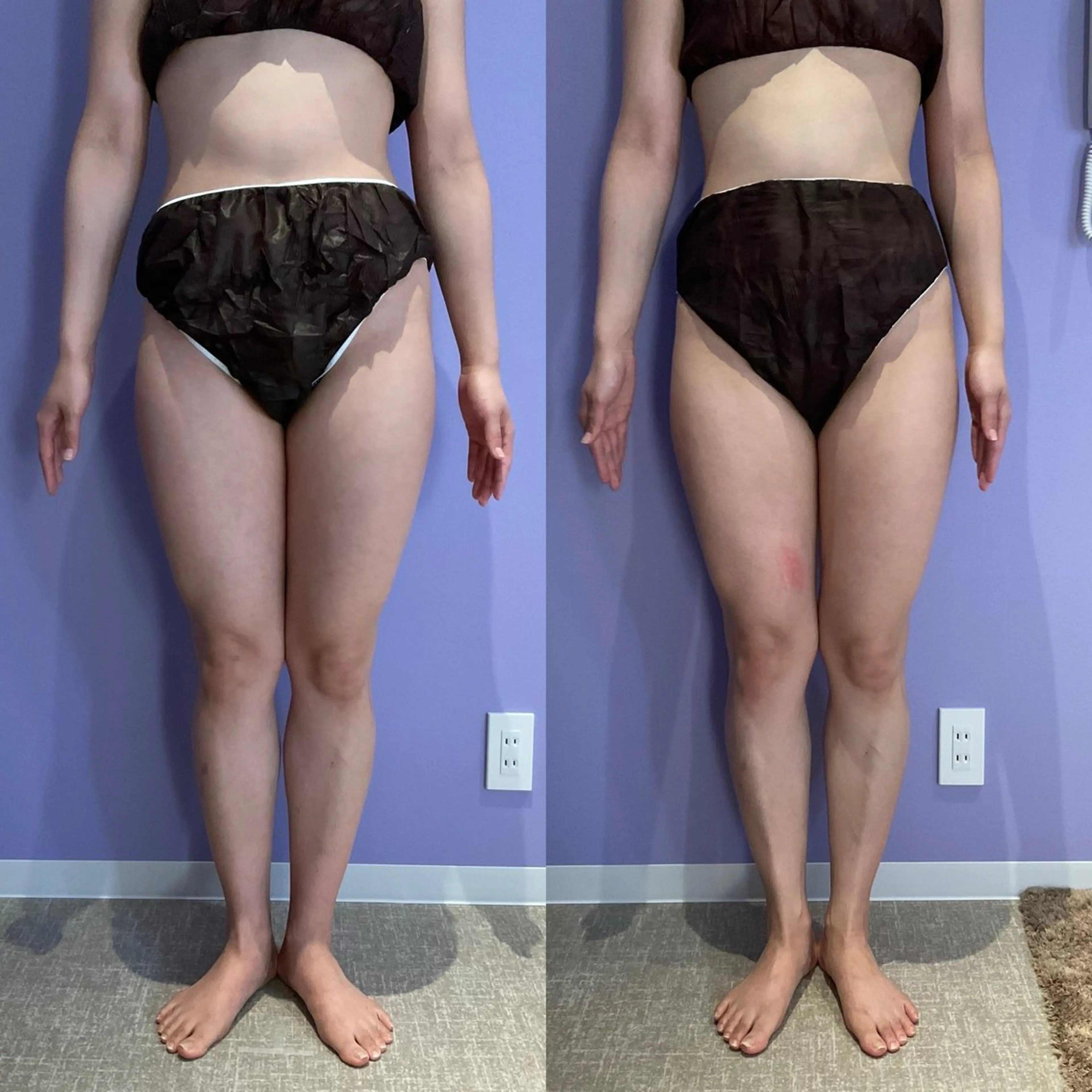 アプローズ所属・恵比寿INDIBA アプローズのエステ・リラクイメージ