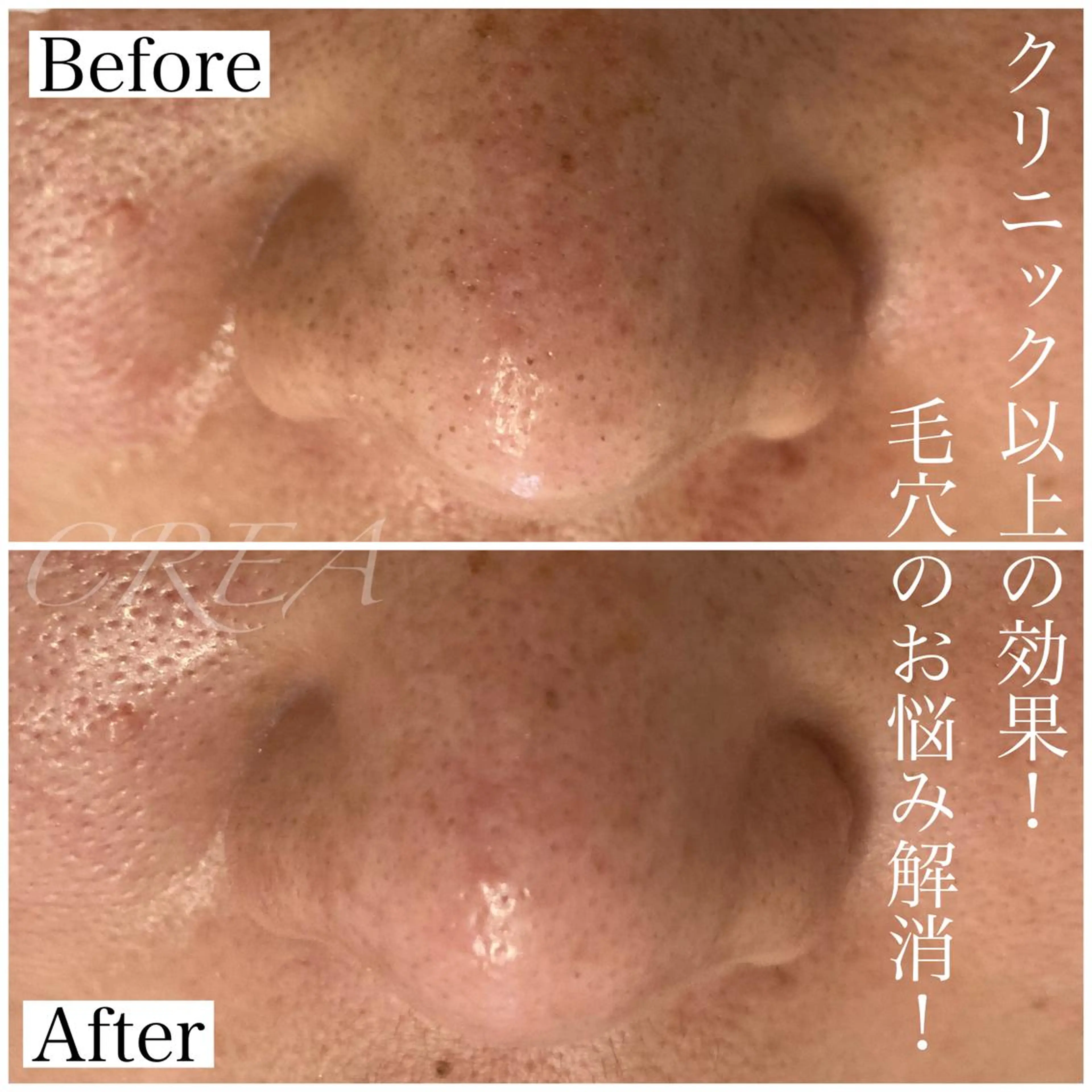 CREA【クレア】 川中のエステ・リラクイメージ