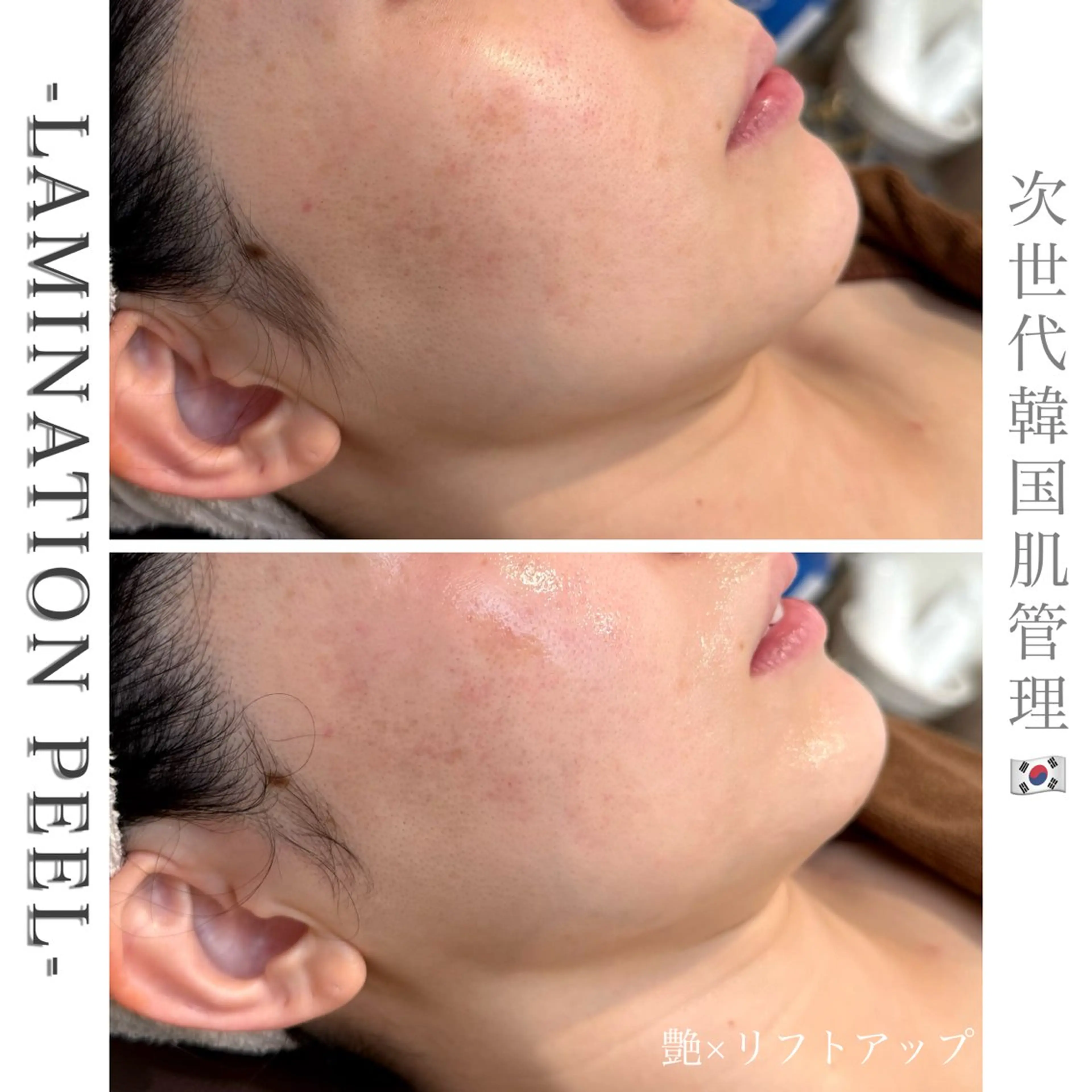 エステ beautysalon RAVIS所属・東大阪/韓国肌管理/ 痩身バスト専門店のエステ・リラクイメージ