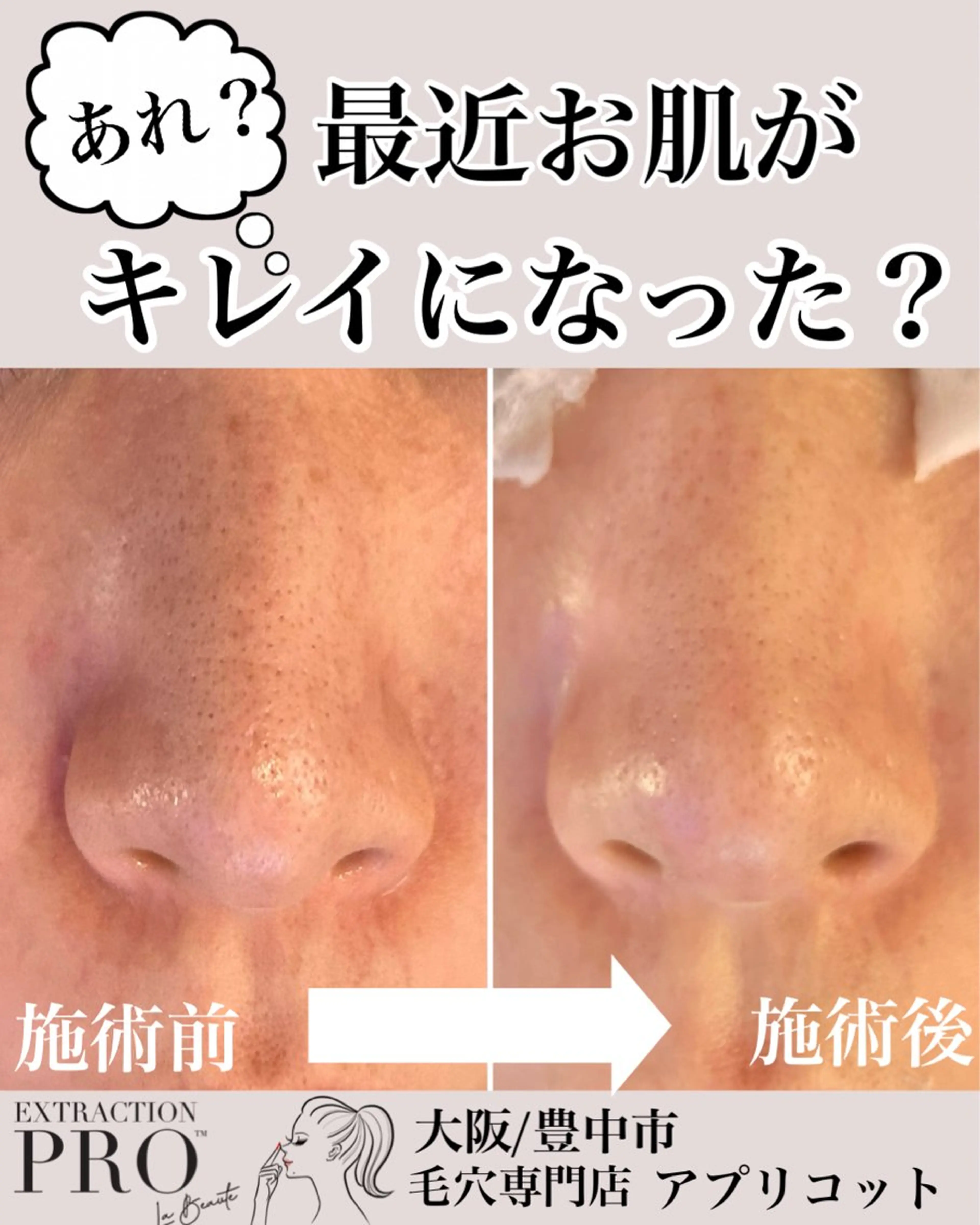 ヘッドスパ専門/豊中 apricotのエステ・リラクイメージ