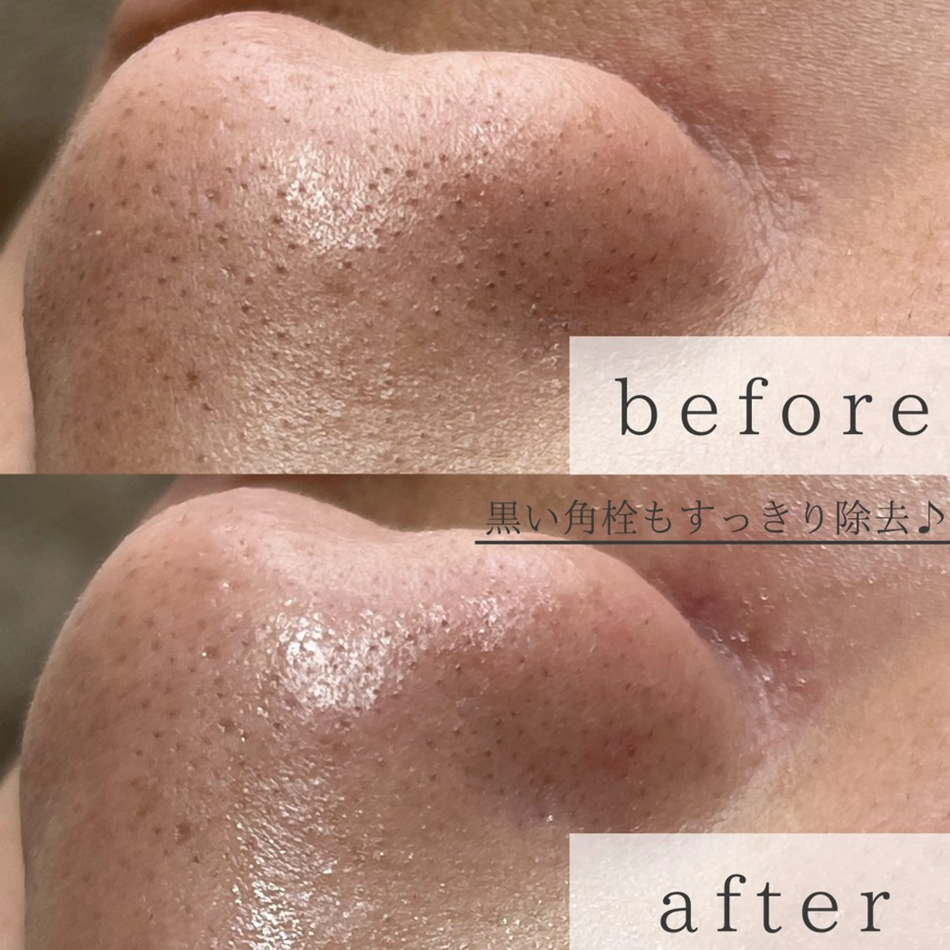 yokohama 🎀miaのマツエク・マツパデザイン