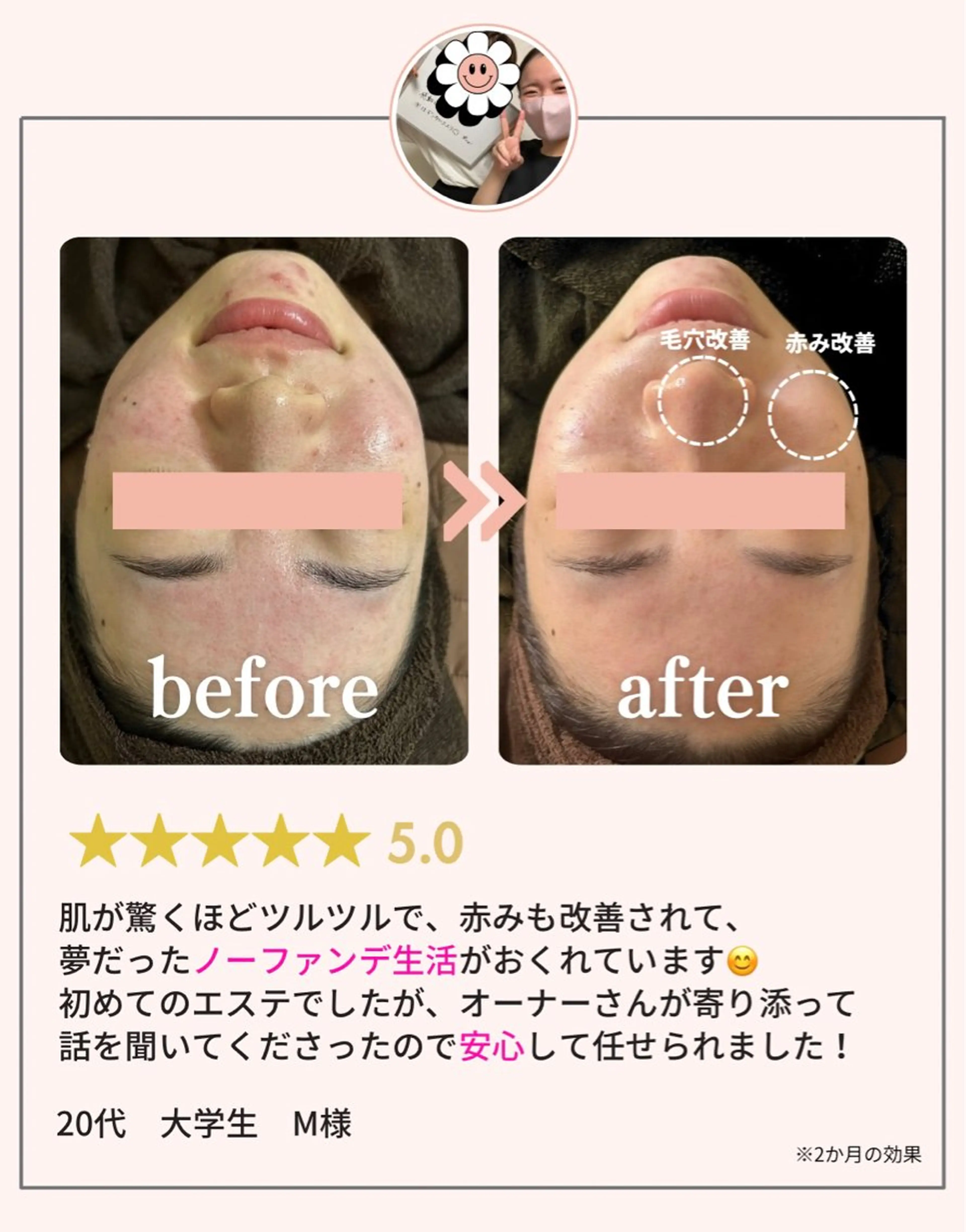 肌質改善・小顔サロン 20代店長RINNAのエステ・リラクイメージ