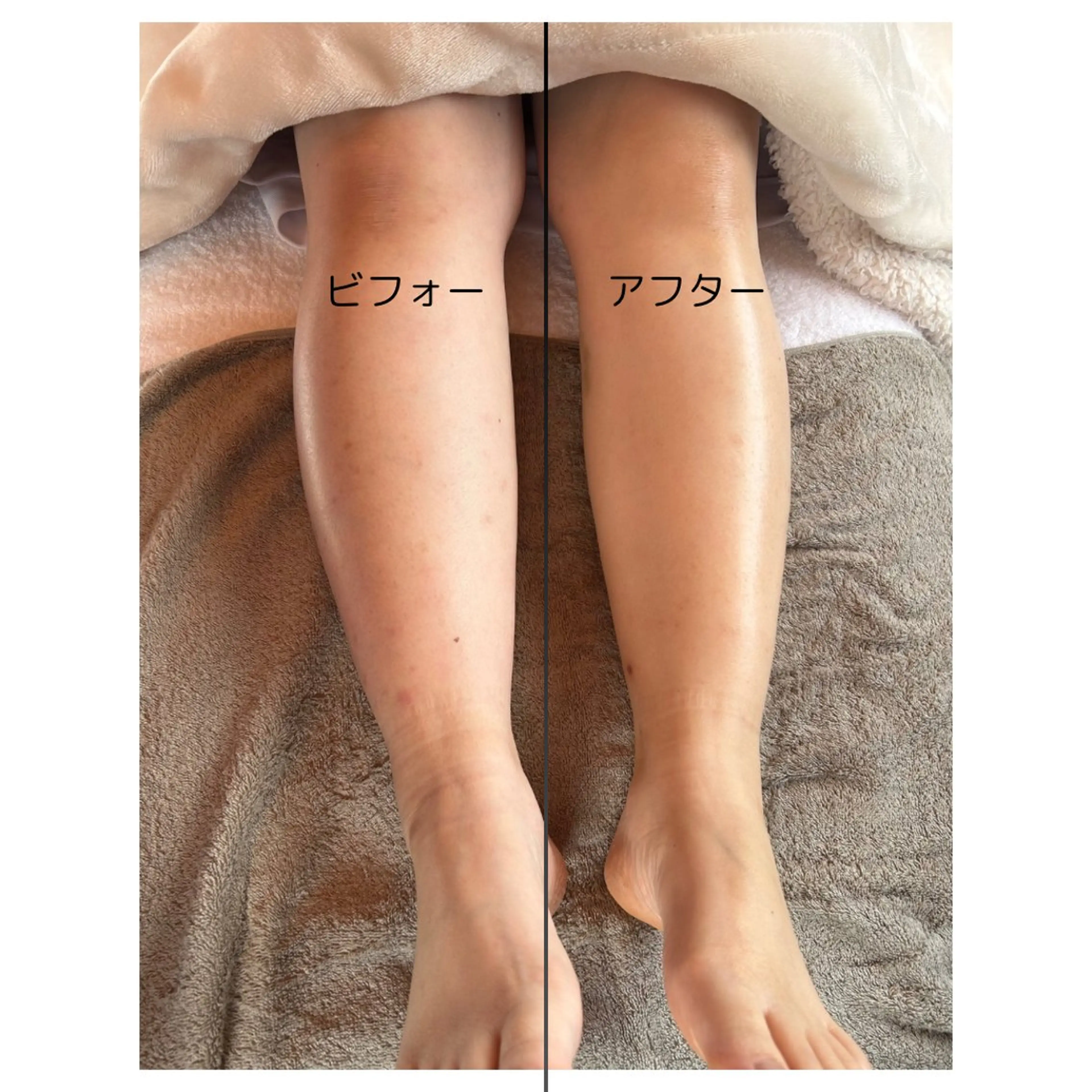 フットアロマトリートメントの写真