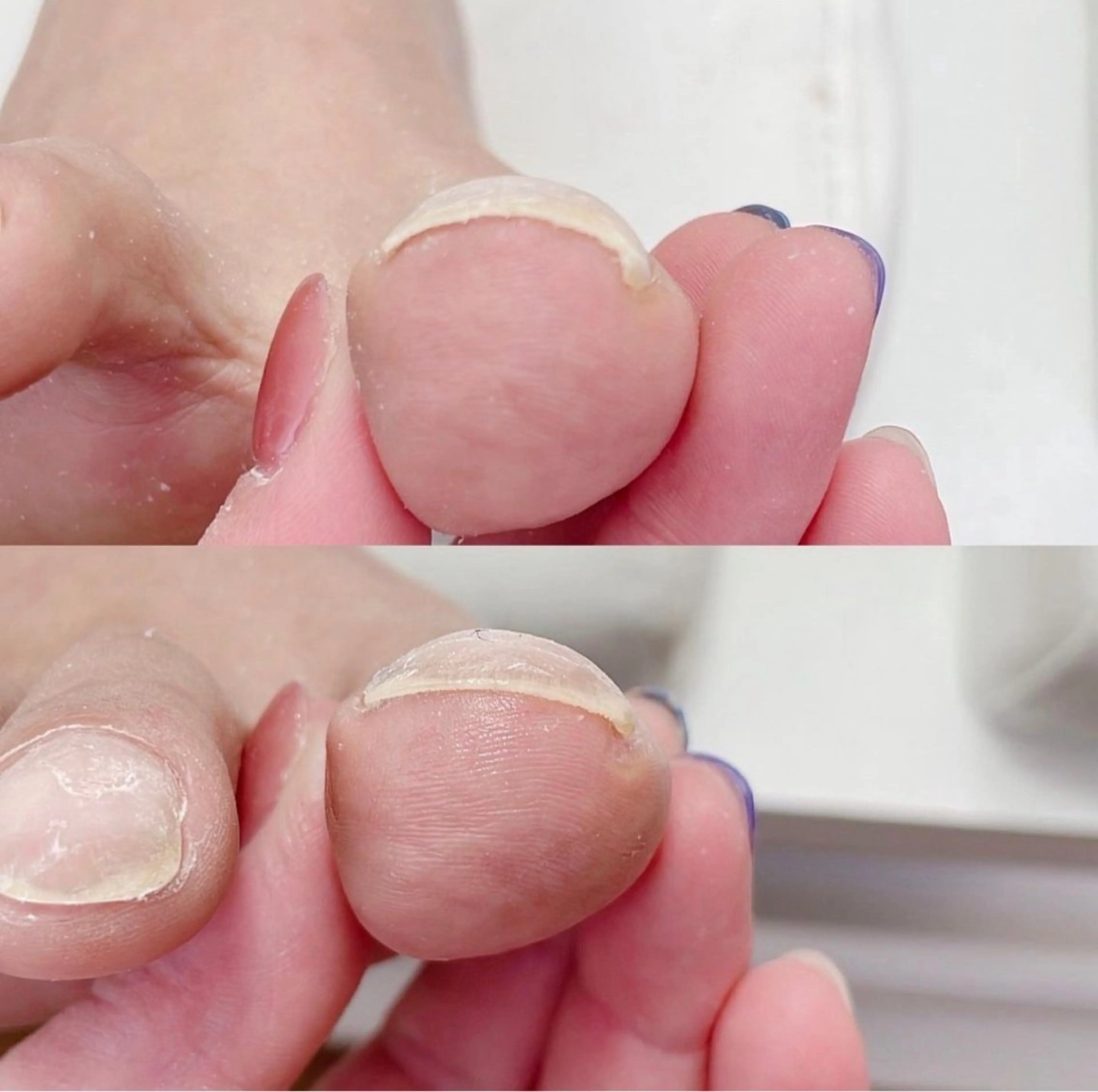 ネイル Alo.nail アロ•ネイルのネイルデザイン