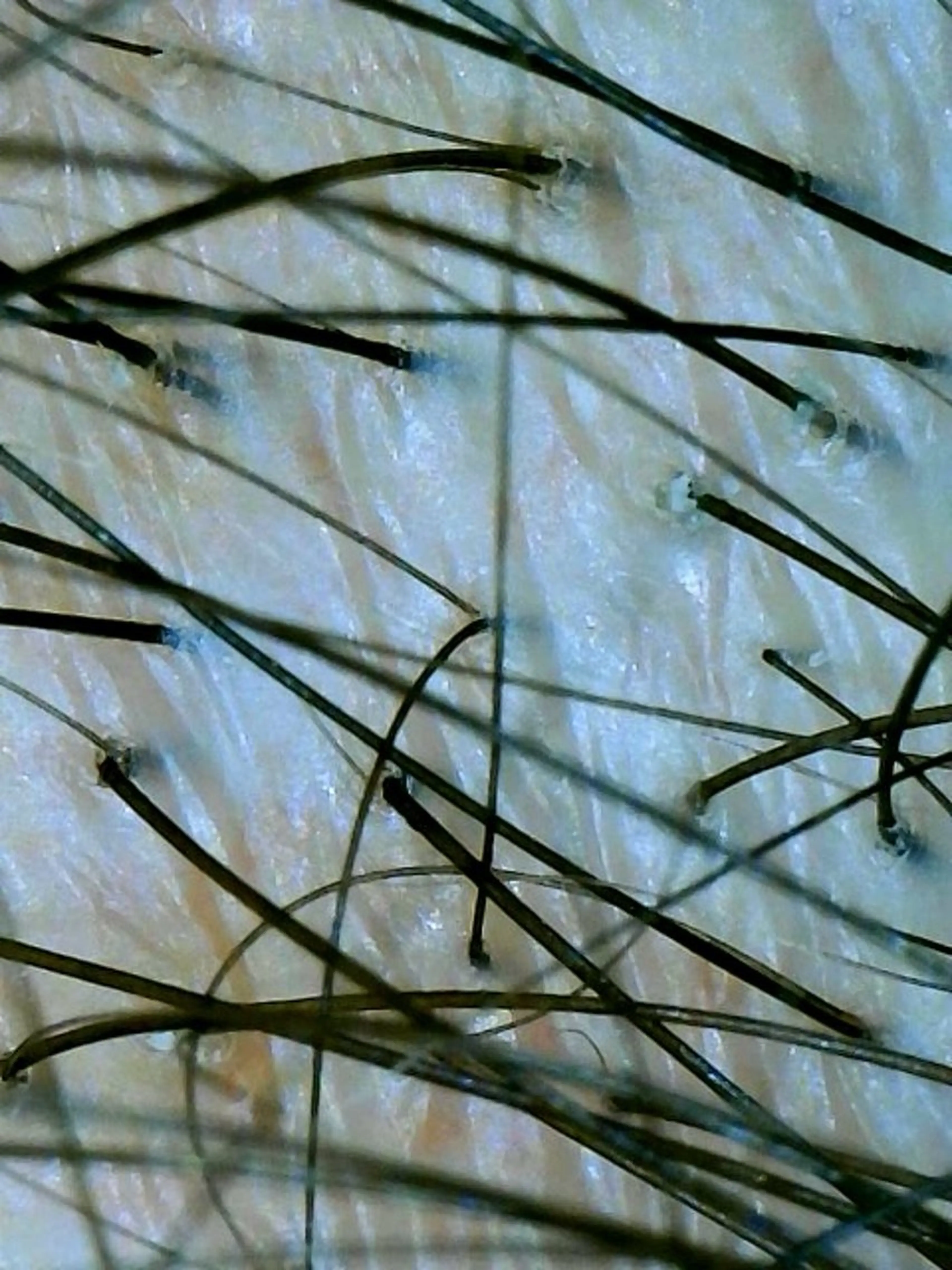 🅖🅤🅩🅔🅛 salonのエステ・リラクイメージ