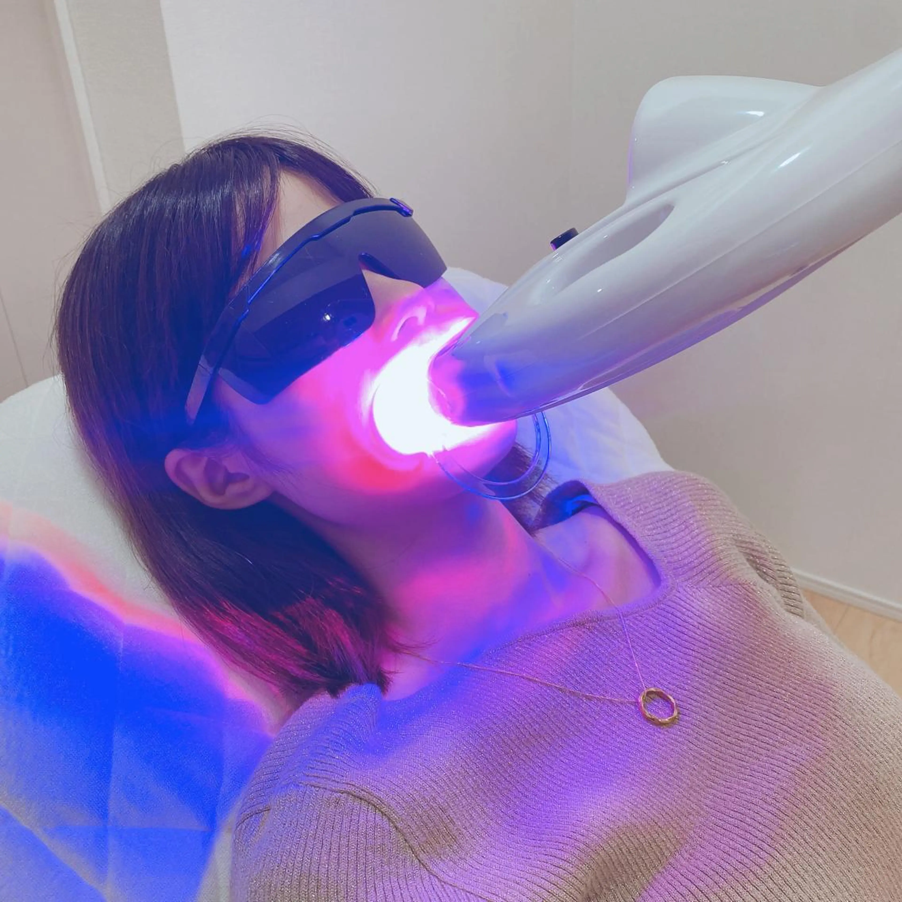 セルフホワイトニング【カウンセリング】の写真