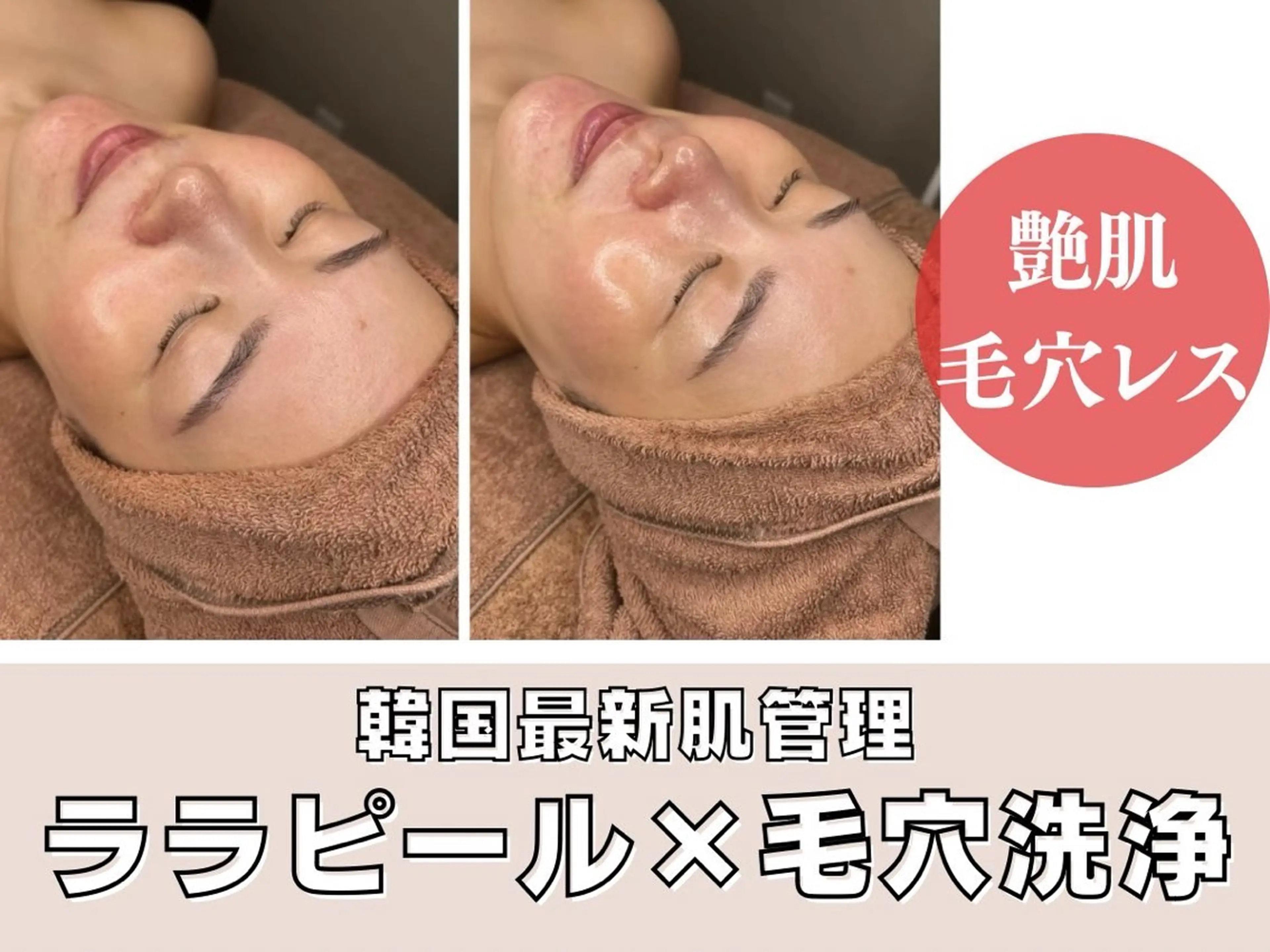 エステ 韓国肌管理専門店 毛穴ピーリング/中野のエステ・リラクイメージ
