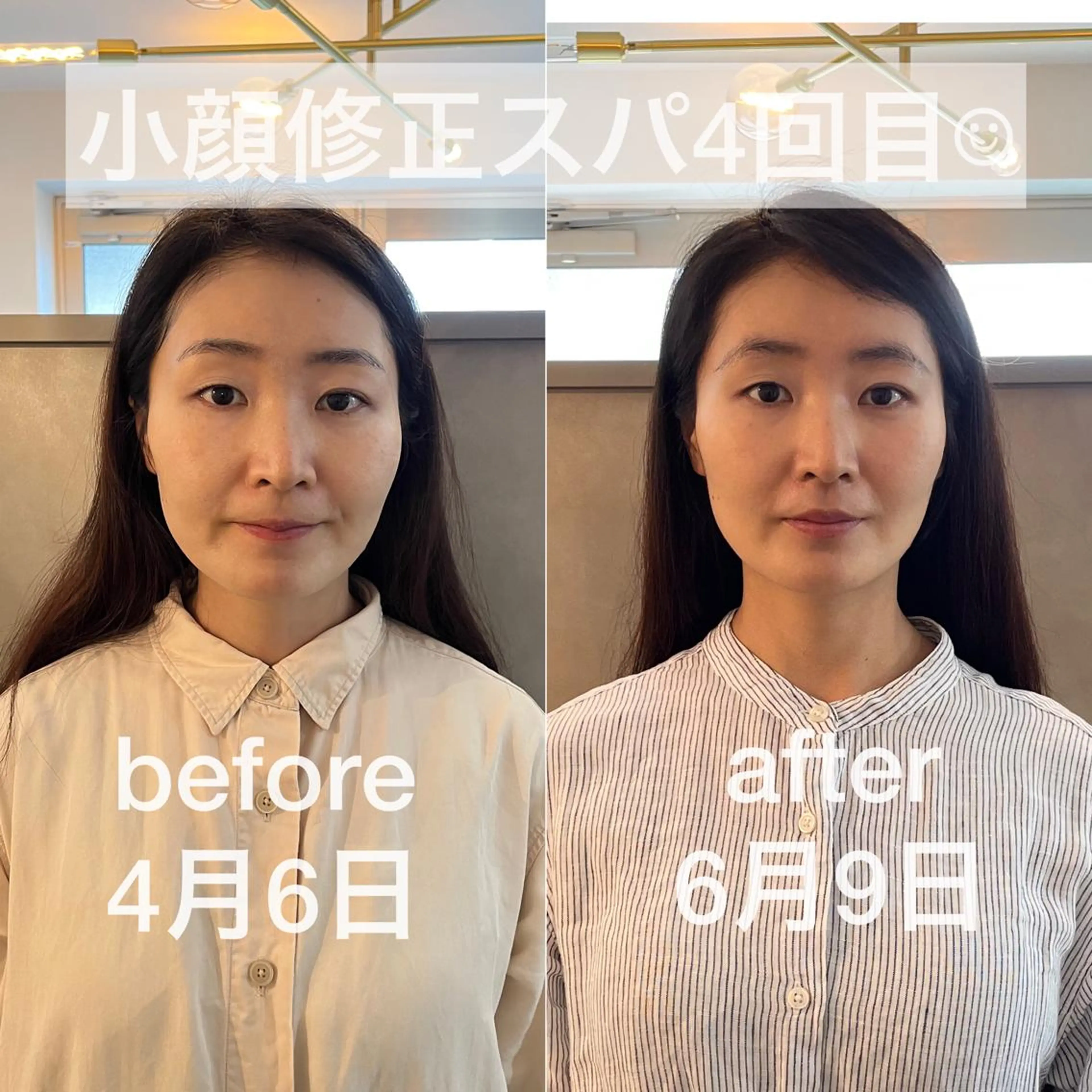 顔写真の撮影モデルさん募集☆小顔修正スパ＋フェイスポインターを使用したお顔のツボ押し（痛いやつです）で浮腫を撃退の写真